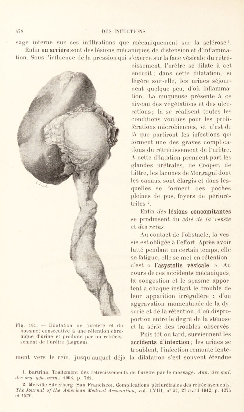 sage interne sur ces infiltrations que mécaniquement sur la scléroseA. Enfin en arriére sont des lésions mécaniques de distension et d’inflamma¬ tion. Sous l’influence de la pression qui Fig. 481. — Dilatation ae l'uretère et du bassinet consécutive à une rétention chro¬ nique d’urine et produite par un rétrécis¬ sement de l’urètre (Legueu). ment, vers le rein, jusqu auquel déjà s’exerce sur la face vésicale du rétré¬ cissement, l’urètre se dilate à cet endroit; dans cette dilatation, si légère soit-elle, les urines séjour¬ nent quelque peu, d’où inflamma¬ tion. La muqueuse présente à ce niveau des végétations et des ulcé¬ rations; là se réalisent toutes les conditions voulues pour les proli¬ férations microbiennes, et c’est de là que partiront les infections qui forment une des graves complica¬ tions du rétrécissement de l'urètre. A cette dilatation prennent part les glandes urétrales, de Cooper, de Littré, les lacunes de Morgagni dont les canaux sont élargis et dans les¬ quelles se forment des poches pleines de pus, foyers de périuré- trites 2. Enfin des lésions concomitantes se produisent du côté de la vessie et des reins. Au contact de 1 obstacle, la ves¬ sie est obligée à l’effort. Après avoir lutté pendant un certain temps, elle se fatigue, elle se met en rétention : c’est « l’asystolie vésicale ». Au cours de ces accidents mécaniques, la congestion et le spasme appor¬ tent à chaque instant le trouble de leur apparition irrégulière ; d’où aggravation momentanée de la dy- surie et de la rétention, d’où dispro¬ portion entre le degré de la sténose et la série des troubles observés. Puis tôt ou tard, surviennent les accidents d’infection ; les urines se troublent, l’infection remonte lente- la dilatation s’est souvent étendue 4. Bartrina. Traitement des rétrécissements de l’urètre par le massage. Ann. des mal. des org. gén.-urin., 1903, p. 721. 2. Melville Silverberg (San Francisco), Complications périurétrales des rétrécissements. The Journal of the American Medical Association, vol. LVIII, n° 37, 27 avril 1912, p. 1275 et 1276. •