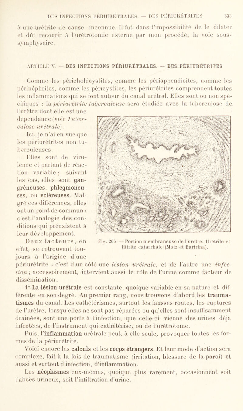 à une urétrite de cause inconnue. Il fut dans l’impossibilité de le dilater et dût recourir à l'urétrotomie externe par mon procédé, la voie sous- symphysaire. ARTICLE V. DES INFECTIONS PÉRIURÉTRALES. — DES PËRIURÉTRITES Comme les péricholécystites, comme les périappendicites, comme les périnéphrites, comme les péncystites, les périurétrites comprennent toutes les inflammations qui se font autour du canal urétral. Elles sont ou non spé¬ cifiques : la périurétrite tuberculeuse sera étudiée avec la tuberculose de l'urètre dont elle est une dépendance (voir Tuber¬ culose urétrcile). Ici, je n’ai en vue que les périurétrites non tu¬ berculeuses. Elles sont de viru¬ lence et partant de réac¬ tion variable ; suivant les cas, elles sont gan¬ gréneuses, phlegmoneu- ses, ou scléreuses. Mal¬ gré ces différences, elles ont un point de commun : c'est l’analogde des con¬ ditions qui préexistent à leur développement. Deux facteurs, en effet, se retrouvent tou¬ jours à l’origine d'une périurétrite : c’est d’un côté une lésion urétrale, et de l’autre une infec¬ tion ; accessoirement, intervient aussi le rôle de l’urine comme facteur de dissémination. 1° La lésion urétrale est constante, quoique variable en sa nature et dif¬ férente en son degré. Au premier rang, nous trouvons d’abord les trauma¬ tismes du canal. Les cathétérismes, surtout les fausses routes, les ruptures de l’urètre, lorsqu’elles ne sont pas réparées ou qu’elles sont insuffisamment drainées, sont une porte à l’infection, que celle-ci vienne des urines déjà infectées, de l’instrument qui cathétérise, ou de l’urétrotome. Puis, l’inflammation urétrale peut, à elle seule, provoquer toutes les for¬ mes de la périurétrite. Voici encore les calculs et les corps étrangers. Et leur mode d’action sera complexe, fait à la fois de traumatisme (irritation, blessure de la paroi) et aussi et surtout d’infection, d’inflammation. Les néoplasmes eux-mêmes, quoique plus rarement, occasionnent soit fabcès urineux, soit l’infiltration d’urine. Fig. 206. — Portion membraneuse de l’urètre. Urétrite et littrite catarrhale (Motz et Bartrina).