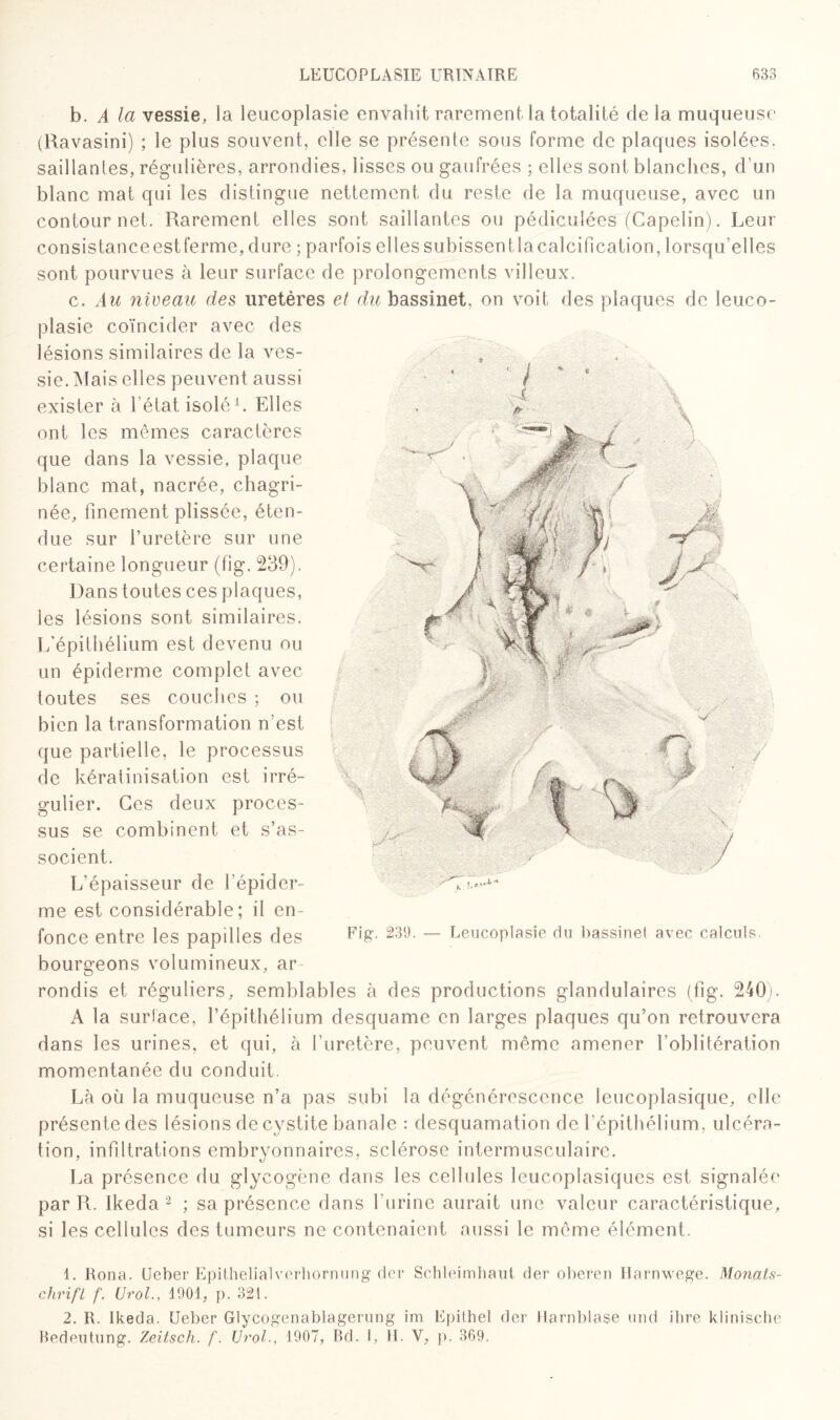 b. A la vessie, la leucoplasie envahît rarement la totalité de la muqueuse (Ravasini) ; le plus souvent, elle se présente sous forme de plaques isolées, saillantes, régulières, arrondies, lisses ou gaufrées ; elles sont blanches, d’un blanc mat qui les distingue nettement du reste de la muqueuse, avec un contour net. Rarement elles sont saillantes ou pédiculées (Capelin). Leur consistance est ferme, dure ; parfois elles subissent la calcification, lorsqu’elles sont pourvues à leur surface de prolongements villeux. c. Au niveau des uretères et du bassinet, on voit des placrues de leuco¬ plasie coïncider avec des lésions similaires de la ves¬ sie. Mais elles peuvent aussi exister à l’état isolé1. Elles ont les mêmes caractères que dans la vessie, plaque blanc mat, nacrée, chagri¬ née, finement plissée, éten¬ due sur l’uretère sur une certaine longueur (fig. 239). Dans toutes ces plaques, les lésions sont similaires. L'épithélium est devenu ou un épiderme complet avec toutes ses couches ; ou bien la transformation n'est que partielle, le processus de kératinisation est irré¬ gulier. Ges deux proces¬ sus se combinent et s’as¬ socient. L’épaisseur de l’épider¬ me est considérable; il en¬ fonce entre les papilles des bourgeons volumineux, ar rondis et réguliers, semblables à des productions glandulaires (fig. 240). A la surface, l’épithélium desquame en larges plaques qu’on retrouvera dans les urines, et qui, à l’uretère, peuvent même amener l’oblitération momentanée du conduit. Là où la muqueuse n’a pas subi la dégénérescence leucoplasique, elle présente des lésions de cystite banale : desquamation de l’épithélium, ulcéra¬ tion, infdtrations embryonnaires, sclérose intermusculaire. La présence du glycogène dans les cellules leucoplasiques est signalée par R. Ikeda 2 ; sa présence dans l’urine aurait une valeur caractéristique, si les cellules des tumeurs ne contenaient aussi le même élément. 1. Rona. (Jeber Epithelialverhornung der Schleimhaut der oberen Harnwege. Monats- chrift f. UroL, 1901, p. 321. 2. R. Ikeda. Ueber Glycogenablagerung im Epithel der Harnblase und ihre klinische Bedeutung. Zeitsch. f. UroL, 1907, Bd. I, H. Y, p. 369,