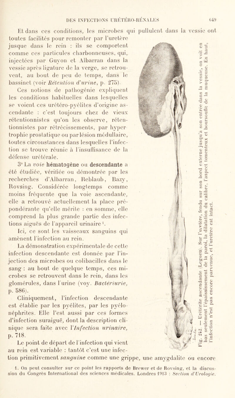ce -03 e, m £ s_, -O Et dans ces conditions, les microbes qui pullulent dans la vessie ont toutes facilités pour remonter par l'uretère jusque dans le rein : ils se comportent comme ces particules charbonneuses, qui, injectées par Guy on et Albarran dans la vessie après ligature de la verge, se retrou¬ vent, au bout de peu de temps, dans le bassinet (voir Rétention d'urine, p. 275). Ces notions de pathogénie expliquent les conditions habituelles dans lesquelles se voient ces urétéro-pyélites d’origine as¬ cendante : c’est toujours chez de vieux rétentionnistes qu’on les observe, réten- tionnistes par rétrécissements, par hyper trophie prostatique ou par lésion médullaire, toutes circonstances dans lesquelles l’infec¬ tion se trouve réunie à l’insuffisance de la défense urétérale. 3° La voie hématogène ou descendante a été étudiée, vérifiée ou démontrée par les recherches d’Albarran, Reblaub, Bazy, Rovsing. Considérée longtemps comme moins fréquente que la voie ascendante, elle a retrouvé actuellement la place pré¬ pondérante qu’elle mérite : en somme, elle comprend la plus grande partie des infec¬ tions aiguës de l'appareil urinaire1. Ici, ce sont les vaisseaux sanguins qui amènent l'infection au rein. La démonstration expérimentale de cette infection descendante est donnée par l’in¬ jection des microbes ou colibacilles dans le sang : au bout de quelque temps, ces mi¬ crobes se retrouvent dans le rein, dans les glomérules, dans l'urine (voy. Bactériurie, p. 586). Cliniquement, l’infection descendante est établie par les pyélites, par les pyélo¬ néphrites. Elle l’est aussi par ces formes d’infection suraiguë, dont la description cli¬ nique sera faite avec Y Infection urinaire, p. 718. Le point de départ de l infection qui vient ^ V’1 ~ ~ ~ au rein est variable : tantôt c’est une infec¬ tion primitivement sanguine comme une grippe, une amygdalite ou encore 1. On peut consulter sur ce point les rapports de Brewer et de Rovsing, et la discus¬ sion du Congrès International des sciences médicales. Londres 1913 : Section cVUrologie. en