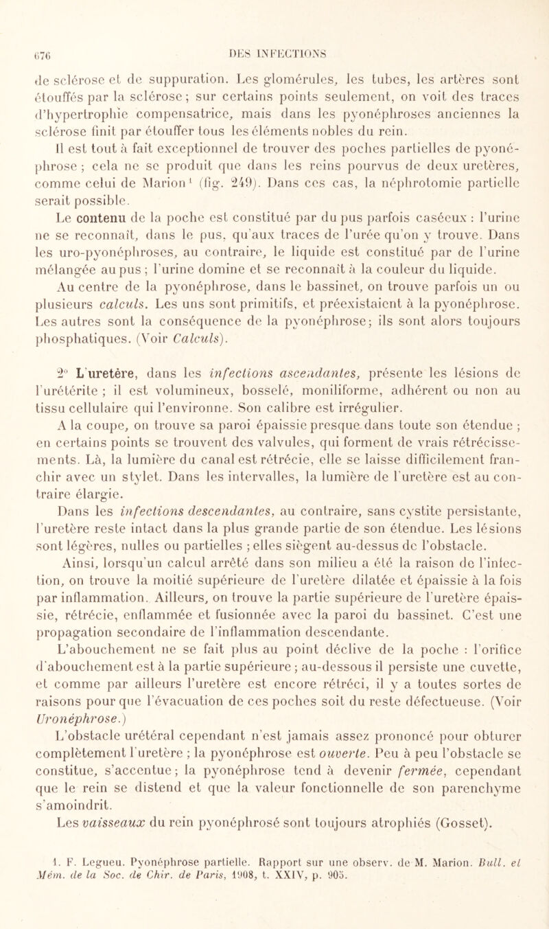 »le sclérose et de suppuration. Les glomérules, les tubes, les artères sont étouffés par la sclérose; sur certains points seulement, on voit des traces d’hypertropliie compensatrice, mais dans les pyonéphroscs anciennes la sclérose finit par étouffer tous les éléments nobles du rein. Il est tout à fait exceptionnel de trouver des poches partielles de pyoné- phrose ; cela ne se produit que dans les reins pourvus de deux uretères, comme celui de Marion1 (fig*. 249). Dans ces cas, la néphrotomie partielle serait possible. Le contenu de la poche est constitué par du pus parfois caséeux : l’urine ne se reconnaît, dans le pus, qu'aux traces de l’urée qu’on y trouve. Dans les uro-pyonéphroses, au contraire, le liquide est constitué par de l’urine mélangée au pus ; l’urine domine et se reconnaît à la couleur du liquide. Au centre de la pyonéphrose, dans le bassinet, on trouve parfois un ou plusieurs calculs. Les uns sont primitifs, et préexistaient à la pyonéphrose. Les autres sont la conséquence de la pyonéphrose; ils sont alors toujours phosphatiques. (Voir Calculs). 2° L uretère, dans les infections ascendantes, présente les lésions de furétérite ; il est volumineux, bosselé, moniliforme, adhérent ou non au tissu cellulaire qui l’environne. Son calibre est irrégulier. A la coupe, on trouve sa paroi épaissie presque dans toute son étendue ; en certains points se trouvent des valvules, qui forment de vrais rétrécisse¬ ments. Là, la lumière du canal est rétrécie, elle se laisse difficilement fran¬ chir avec un stylet. Dans les intervalles, la lumière de l'uretère est au con¬ traire élargie. Dans les infections descendantes, au contraire, sans cystite persistante, l’uretère reste intact dans la plus grande partie de son étendue. Les lésions sont légères, nulles ou partielles ; elles siègent au-dessus de l’obstacle. Ainsi, lorsqu'un calcul arrêté dans son milieu a été la raison de l’infec- tion, on trouve la moitié supérieure de l’uretère dilatée et épaissie à la fois par inflammation. Ailleurs, on trouve la partie supérieure de l'uretère épais- sie, rétrécie, enflammée et fusionnée avec la paroi du bassinet. C’est une propagation secondaire de l'inflammation descendante. L’abouchement ne se fait plus au point déclive de la poche : l’orifice d'abouchement est à la partie supérieure ; au-dessous il persiste une cuvette, et comme par ailleurs l’uretère est encore rétréci, il y a toutes sortes de raisons pour que l'évacuation de ces poches soit du reste défectueuse. (Voir Uronéphrose.) L’obstacle urétéral cependant n’est jamais assez prononcé pour obturer complètement 1 uretère ; la pyonéphrose est ouverte. Peu à peu l’obstacle se constitue, s’accentue; la pyonéphrose tend à devenir fermée, cependant que le rein se distend et que la valeur fonctionnelle de son parenchyme s'amoindrit. Les vaisseaux du rein pyonéphrosé sont toujours atrophiés (Gosset). I. F. Legueu. Pyonéphrose partielle. Rapport sur une observ. de M. Marion. Bull, et Mém. de la Soc. de Chir. de Paris, 1908, t. XXIV, p. 905.