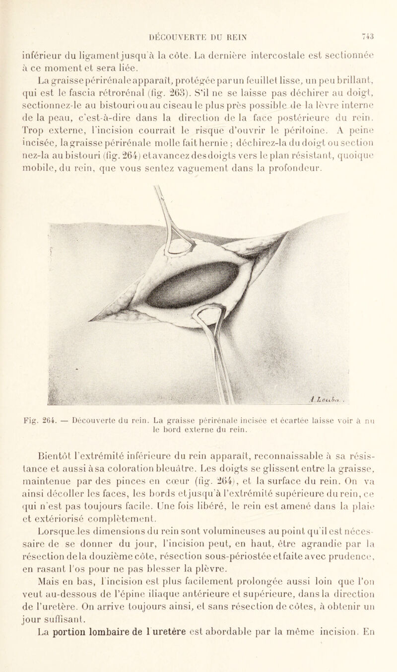 inférieur du ligament jusqu'à la côte. La dernière intercostale est sectionnée à ce moment et sera liée. La graisse périrénale apparaît, protégée par un feuillet lisse, un peu brillant , qui est le fascia rétrorénal (fig. 263). S’il ne se laisse pas déchirer au doigt, sectionnez-le au bistouri ou au ciseau le plus près possible de la lèvre interne de 1a. peau, c’est-à-dire dans la direction delà face postérieure du rein. Trop externe, l'incision courrait le risque d’ouvrir le péritoine. A peine incisée, la graisse périrénale molle fait hernie; décbirez-la du doigt ou section nez-la au bistouri (fig. 264) et avancez des doigts vers le plan résistant, quoique mobile, du rein, que vous sentez vaguement dans la profondeur. TjiiHiho . Fig. 264. — Découverte du rein. La graisse périrénale incisée et écartée laisse voir à nu le bord externe du rein. Bientôt l’extrémité inférieure du rein apparaît, reconnaissable à sa résis¬ tance et aussi àsa coloration bleuâtre. Les doigts se glissent entre la graisse, maintenue par des pinces en cœur (fig. 264), et la surface du rein. On va ainsi décoller les faces, les bords et jusqu’à l’extrémité supérieure du rein, ce qui n'est pas toujours facile. Une fois libéré, le rein est amené dans la plaie et extériorisé complètement. Lorsque les dimensions du rein sont volumineuses au point qu’il est néces¬ saire de se donner du jour, l’incision peut, en haut, être agrandie par la résection delà douzième côte, résection sous-périostée et faite avec prudence, en rasant l’os pour ne pas blesser la plèvre. Mais en bas, 1 incision est plus facilement prolongée aussi loin que l’on veut au-dessous de l’épine iliaque antérieure et supérieure, dans la direction de l’uretère. On arrive toujours ainsi, et sans résection de côtes, à obtenir un jour suffisant. La portion lombaire de 1 uretère est abordable par la même incision. En