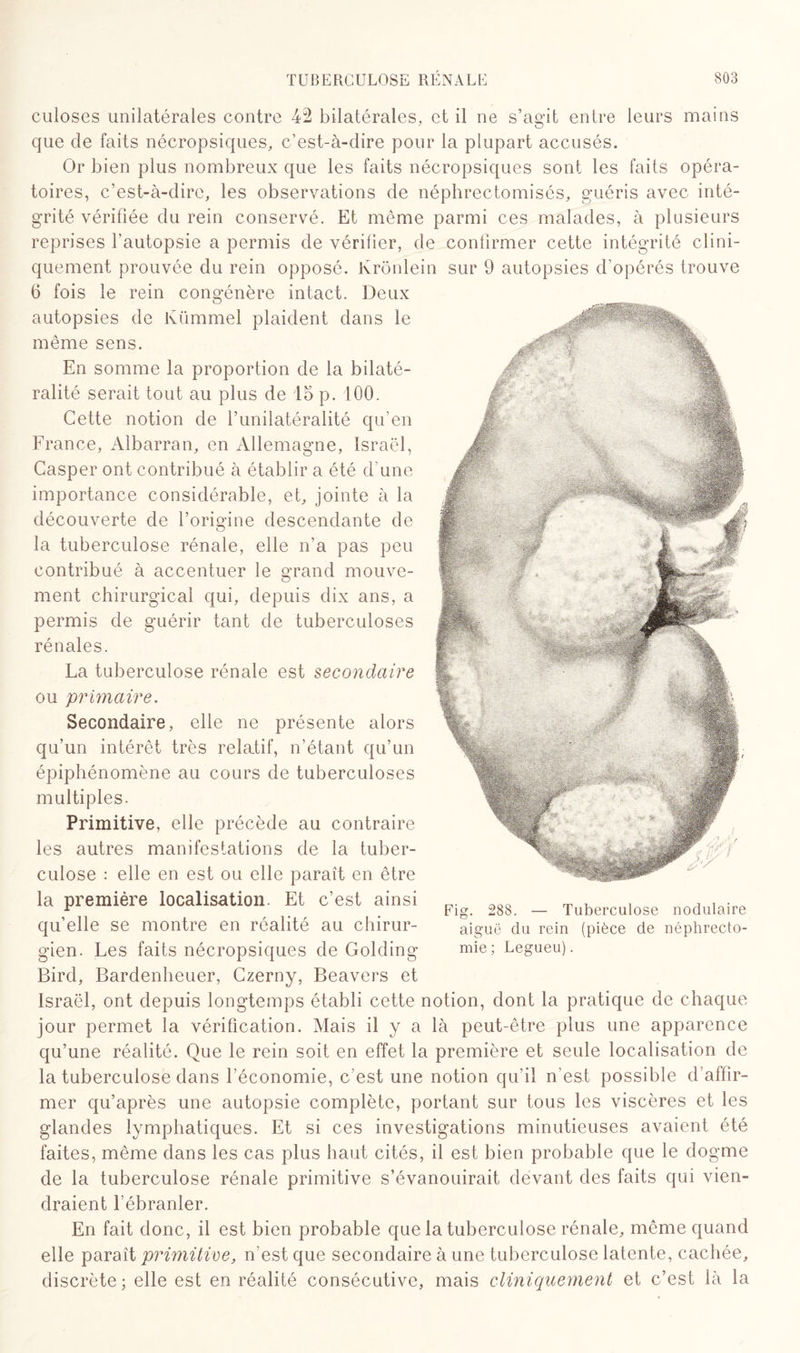 culoses unilatérales contre 42 bilatérales, et il ne s’agit entre leurs mains que de faits nécropsiques, c’est-à-dire pour la plupart accusés. Or bien plus nombreux que les faits nécropsiques sont les faits opéra¬ toires, c’est-à-dire, les observations de néphrectomisés, guéris avec inté¬ grité vérifiée du rein conservé. Et même parmi ces malades, à plusieurs reprises l'autopsie a permis de vérifier, de confirmer cette intégrité clini¬ quement prouvée du rein opposé. Krônlein sur 9 autopsies d’opérés trouve 6 fois le rein congénère intact. Deux autopsies de Ivümmel plaident dans le même sens. En somme la proportion de la bilaté¬ ralité serait tout au plus de 15 p. 100. Cette notion de l’unilatéralité qu’en France, Albarran, en Allemagne, Israël, Casper ont contribué à établir a été d’une importance considérable, et, jointe à la découverte de l’origine descendante de la tuberculose rénale, elle n’a pas peu contribué à accentuer le grand mouve¬ ment chirurgical qui, depuis dix ans, a permis de guérir tant de tuberculoses rénales. La tuberculose rénale est secondaire ou primaire. Secondaire, elle ne présente alors qu’un intérêt très relatif, n’étant qu’un épiphénomène au cours de tuberculoses multiples. Primitive, elle précède au contraire les autres manifestations de la tuber¬ culose : elle en est ou elle paraît en être la première localisation. Et c’est ainsi qu’elle se montre en réalité au chirur¬ gien. Les faits nécropsiques de Golding Bird, Bardenheuer, Czerny, Beavers et Israël, ont depuis longtemps établi cette notion, dont la pratique de chaque jour permet la vérification. Mais il y a là peut-être plus une apparence qu’une réalité. Que le rein soit en effet la première et seule localisation de la tuberculose dans l’économie, c’est une notion qu’il n’est possible d’affir- mer qu’après une autopsie complète, portant sur tous les viscères et les glandes lymphatiques. Et si ces investigations minutieuses avaient été faites, même dans les cas plus haut cités, il est bien probable que le dogme de la tuberculose rénale primitive s’évanouirait devant des faits qui vien¬ draient l’ébranler. En fait donc, il est bien probable que la tuberculose rénale, même quand elle paraît primitive, n’est que secondaire à une tuberculose latente, cachée, discrète; elle est en réalité consécutive, mais cliniquement et c’est là la Fig. 288. — Tuberculose nodulaire aiguë du rein (pièce de néphrecto¬ mie ; Legueu).