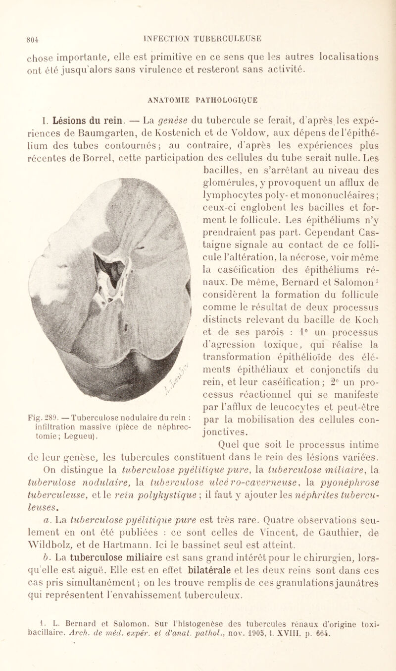 chose importante, elle est primitive en ce sens que les autres localisations ont été jusqu’alors sans virulence et resteront sans activité. ANATOMIE PATHOLOGIQUE I. Lésions du rein. — La genèse du tubercule se ferait, d’après les expé¬ riences de Baumgarten, de Kostenich et de Yoldow, aux dépens de l’épithé¬ lium des tubes contournés; au contraire, d’après les expériences plus récentes de Borrel, cette participation des cellules du tube serait nulle. Les bacilles, en s’arrêtant au niveau des glomérules, y provoquent un afflux de lymphocytes poly- et mononucléaires ; ceux-ci englobent les bacilles et for¬ ment le follicule. Les épithéliums n’y prendraient pas part. Cependant Cas- taigne signale au contact de ce folli¬ cule l’altération, la nécrose, voir même la caséification des épithéliums ré¬ naux. De même, Bernard et Salomon1 considèrent la formation du follicule comme le résultat de deux processus distincts relevant du bacille de lvoch et de ses parois : 1° un processus d’agression toxique, qui réalise la transformation épithélioïde des élé¬ ments épithéliaux et conjonctifs du rein, et leur caséification; 2° un pro¬ cessus réactionnel qui se manifeste par l’afflux de leucocytes et peut-être par la mobilisation des cellules con¬ jonctives. Quel que soit le processus intime de leur genèse, les tubercules constituent dans le rein des lésions variées. On distingue la tuberculose pyélitique pure, la tuberculose miliaire, la tuberulose nodulaire, la tuberculose ulcé ro-caverneuse, la pyonéphrose tuberculeuse, et le rein polykystique ; il faut y ajouter les néphrites tubercu¬ leuses. a. La tuberculose pyélitique pure est très rare. Quatre observations seu¬ lement en ont été publiées : ce sont celles de Vincent, de Gauthier, de Wildbolz, et de Hartmann. Ici le bassinet seul est atteint. b. La tuberculose miliaire est sans grand intérêt pour le chirurgien, lors¬ qu’elle est aiguë. Elle est en effet bilatérale et les deux reins sont dans ces cas pris simultanément; on les trouve remplis de ces granulations jaunâtres qui représentent l'envahissement tuberculeux. 1. L. Bernard et Salomon. Sur l’histogenèse des tubercules rénaux d’origine toxi- bacillaire. Arch. de méd. expér. et d’anat. pcithol., nov. 1905, t. XVIII, p. 664. Fig. 289. — Tuberculose nodulaire du rein : infiltration massive (pièce de néphrec¬ tomie ; Legueu).