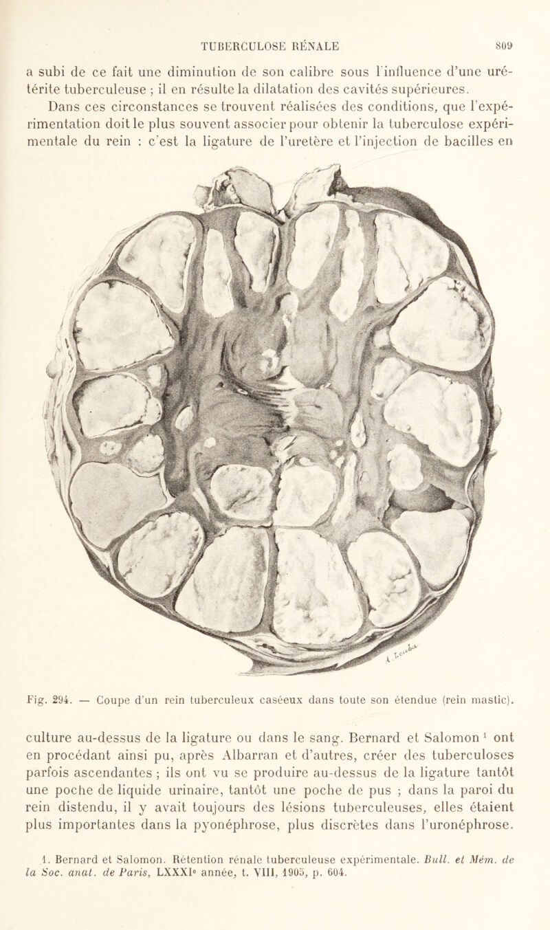 a subi de ce fait une diminution de son calibre sous l'influence d’une uré- térite tuberculeuse ; il en résulte la dilatation des cavités supérieures. Dans ces circonstances se trouvent réalisées des conditions, que l’expé¬ rimentation doit le plus souvent associer pour obtenir la tuberculose expéri¬ mentale du rein : c’est la ligature de l’uretère et l’injection de bacilles en Fig. 294. — Coupe d’un rein tuberculeux caséeux dans toute son étendue (rein mastic). culture au-dessus de la ligature ou dans le sang. Bernard et Salomon 1 ont en procédant ainsi pu, après Albarran et d’autres, créer des tuberculoses parfois ascendantes ; ils ont vu se produire au-dessus de la ligature tantôt une poche de liquide urinaire, tantôt une poche de pus ; dans la paroi du rein distendu, il y avait toujours des lésions tuberculeuses, elles étaient plus importantes dans la pyonéphrose, plus discrètes dans l’uronéphrose. 1. Bernard et Salomon. Rétention rénale tuberculeuse expérimentale. Bull, et Mém. de la Soc. anat. de Paris, LXXXI® année, t. VIII, 1905, p. 604.