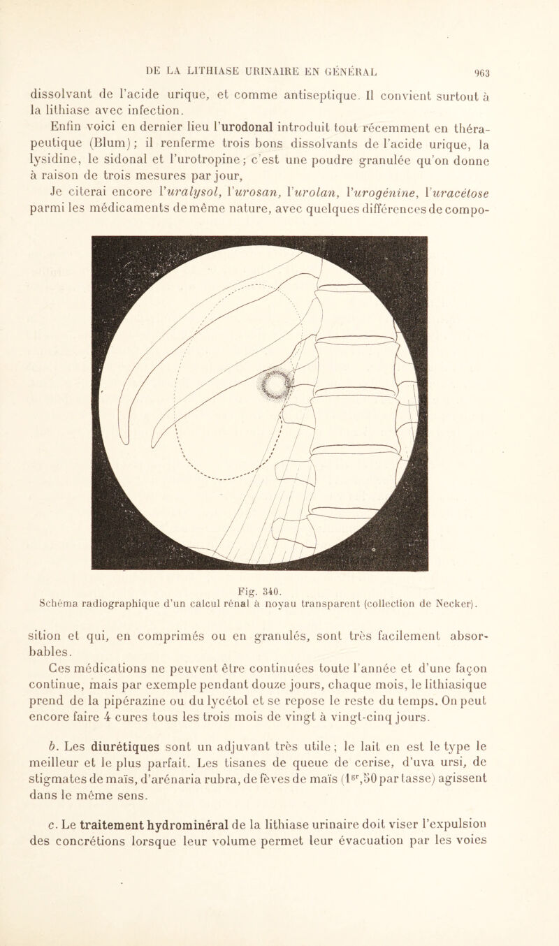 dissolvant de l’acide urique, et comme antiseptique. Il convient surtout à la lithiase avec infection. Enlin voici en dernier lieu l’urodonal introduit tout récemment en théra¬ peutique (Blum) ; il renferme trois bons dissolvants de lacide urique, la lysidine, le sidonal et l’urotropine; c’est une poudre granulée qu’on donne à raison de trois mesures par jour, Je citerai encore Yuralysol, Yurosan, Yurolan, Yurogénine, Yuracétose parmi les médicaments de même nature, avec quelques différences de compo- Fig. 340. Schéma radiographique d’un calcul rénal à noyau transparent (collection de Necker). sition et qui, en comprimés ou en granulés, sont très facilement absor¬ bables. Ces médications ne peuvent être continuées toute l’année et d’une façon continue, mais par exemple pendant douze jours, chaque mois, le lithiasique prend de la pipérazine ou du lycétol et se repose le reste du temps. On peut encore faire 4 cures tous les trois mois de vingt à vingt-cinq jours. b. Les diurétiques sont un adjuvant très utile ; le lait en est le type le meilleur et le plus parfait. Les tisanes de queue de cerise, d’uva ursi, de stigmates de maïs, d’arénaria rubra, de fèves de maïs (lsr,50 par tasse) agissent dans le même sens. c. Le traitement hydrominéral de la lithiase urinaire doit viser l’expulsion des concrétions lorsque leur volume permet leur évacuation par les voies