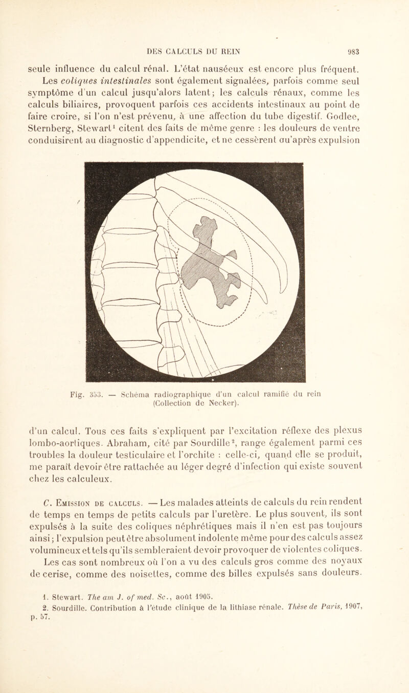 seule influence du calcul rénal. L’état nauséeux est encore plus fréquent. Les coliques intestinales sont également signalées, parfois comme seul symptôme d'un calcul jusqu’alors latent; les calculs rénaux, comme les calculs biliaires, provoquent parfois ces accidents intestinaux au point de faire croire, si l’on n’est prévenu, à une affection du tube digestif. Godlee, Sternberg, Stewart1 citent des faits de même genre : les douleurs de ventre conduisirent au diagnostic d’appendicite, et ne cessèrent ou’après expulsion Fig. 353. Schéma radiographique d'un calcul ramifié du rein (Collection de Necker). d’un calcul. Tous ces faits s’expliquent par l’excitation réflexe des plexus lombo-aorüques. Abraham, cité par Sourdille2, range également parmi ces troubles la douleur testiculaire et l’orchite : celle-ci, quand elle se produit, me parait devoir être rattachée au léger degré d’infection qui existe souvent chez les calculeux. C. Emission de calculs. —Les malades atteints de calculs du rein rendent de temps en temps de petits calculs par l’uretère. Le plus souvent, ils sont expulsés à la suite des coliques néphrétiques mais il n’en est pas toujours ainsi ; l’expulsion peut être absolument indolente même pour des calculs assez volumineux ettels qu’ils sembleraient devoir provoquer de violentes coliques. Les cas sont nombreux où l’on a vu des calculs gros comme des noyaux de cerise, comme des noisettes, comme des billes expulsés sans douleurs. 1. Stewart. The am J. of med. Sc., août 1905. 2. Sourdille. Contribution à Fétude clinique de la lithiase rénale. Thèse de Paris, 1907, p. 57.