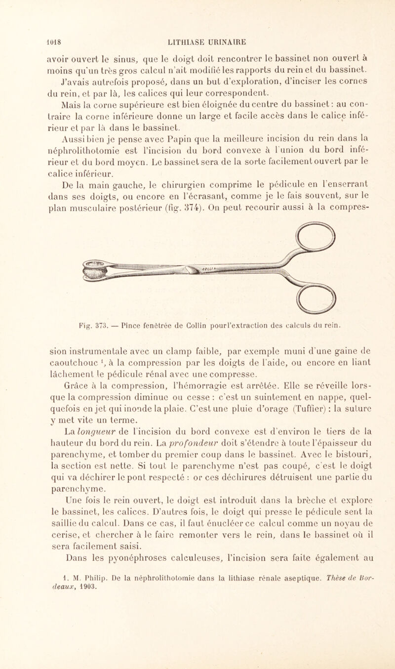 avoir ouvert le sinus, que le doigt doit rencontrer le bassinet non ouvert à moins qu'un très gros calcul n’ait modifié les rapports du rein et du bassinet. J’avais autrefois proposé, dans un but d’exploration, d’inciser les cornes du rein, et par là, les calices qui leur correspondent. Mais la corne supérieure est bien éloignée du centre du bassinet: au con¬ traire la corne inférieure donne un large et facile accès dans le calice infé¬ rieur et par là dans le bassinet. Aussi bien je pense avec Papin que la meilleure incision du rein dans la néphrolithotomie est l’incision du bord convexe à l union du bord infé¬ rieur et du bord moyen. Le bassinet sera de la sorte facilement ouvert par le calice inférieur. De la main gauche, le chirurgien comprime le pédicule en l'enserrant dans ses doigts, ou encore en l’écrasant, comme je le fais souvent, sur le plan musculaire postérieur (fig. 874). On peut recourir aussi à la compres- Fig. 373. — Pince fenètrée de Collin pourl’extraction des calculs du rein. sion instrumentale avec un clamp faible, par exemple muni d’une gaine de caoutchouc i, à la compression par les doigts de l’aide, ou encore en liant lâchement le pédicule rénal avec une compresse. Grâce à la compression, l’hémorragie est arrêtée. Elle se réveille lors¬ que la compression diminue ou cesse : c’est un suintement en nappe, quel¬ quefois en jet qui inonde la plaie. C’est une pluie d’orage (Tuffier) : la suture y met vite un terme. La longueur de l’incision du bord convexe est d’environ le tiers de la hauteur du bord du rein. La profondeur doit s’étendre à toute l’épaisseur du parenchyme, et tomber du premier coup dans le bassinet. Avec le bistouri, la section est nette. Si tout le parenchyme n’est pas coupé, c'est le doigt qui va déchirer le pont respecté : or ces déchirures détruisent une partie du parenchyme. Une fois le rein ouvert, le doigt est introduit dans la brèche et explore le bassinet, les calices. D’autres fois, le doigt qui presse le pédicule sent la saillie du calcul. Dans ce cas, il faut énucléerce calcul comme un noyau de cerise, et chercher à le faire remonter vers le rein, dans le bassinet où il sera facilement saisi. Dans les pyonéphroses calculeuses, l’incision sera faite également au 1. M. Philip. De la néphrolithotomie dans la lithiase rénale aseptique. Thèse de Bor¬ deaux, 1903.