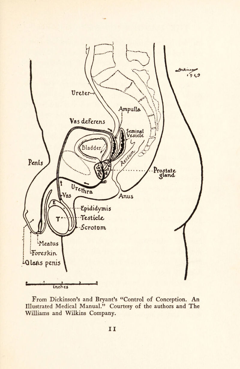 From Dickinson’s and Bryant’s “Control of Conception. An Illustrated Medical Manual.” Courtesy of the authors and The Williams and Wilkins Company.