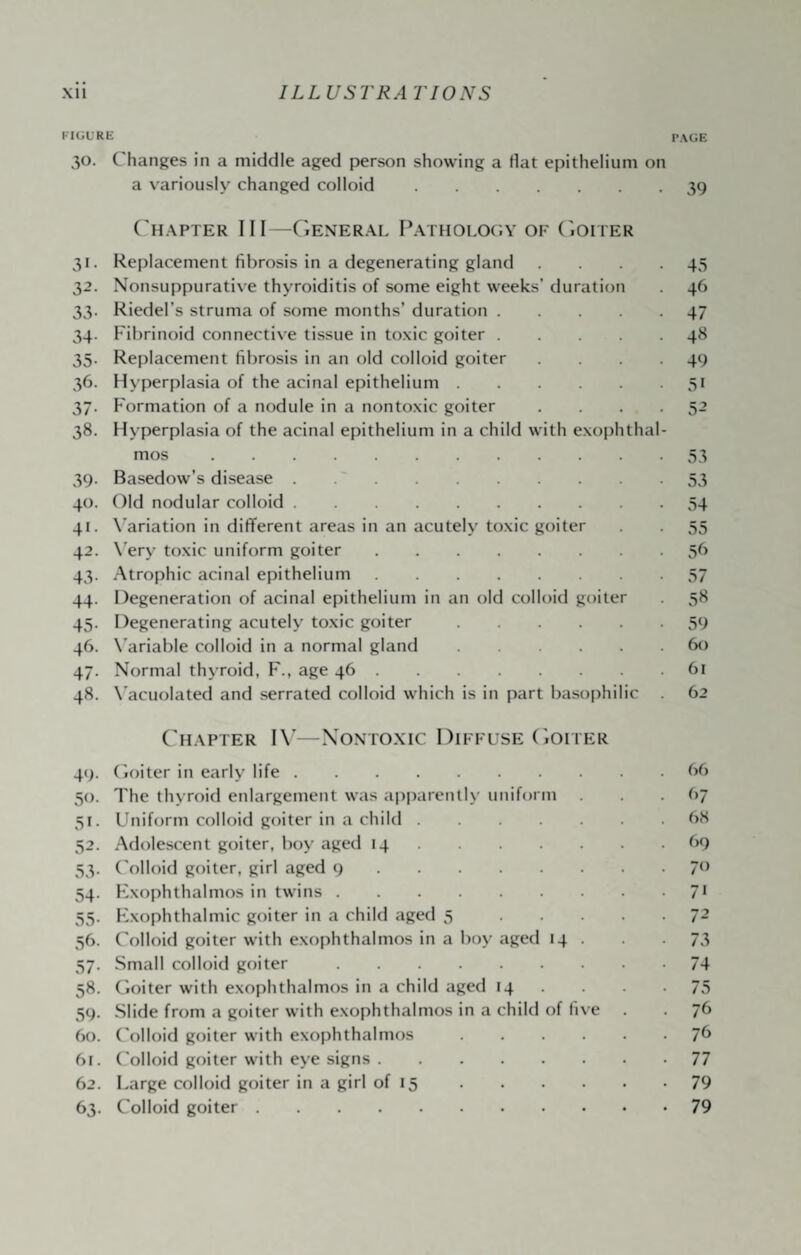 FIGURE 30. Changes in a middle aged person showing a flat epithelium on a variously changed colloid. ('hapter III —General Patholol.y of (iOiter 31. Replacement fibrosis in a degenerating gland . . . . 32. Nonsuppurative thyroiditis of some eight weeks’ duration 33. Riedel’s struma of some months’ duration. 34. Fibrinoid connective tissue in toxic goiter. 35. Replacement fibrosis in an old colloid goiter .... 36. Hyperplasia of the acinal epithelium. 37. Formation of a nodule in a nontoxic goiter .... 38. Hyperplasia of the acinal epithelium in a child with exophthal¬ mos . 39. Basedow’s disease. 40. Old nodular colloid. 41. X’ariation in different areas in an acutely toxic goiter 42. \’ery toxic uniform goiter. 43. .Atrophic acinal epithelium. 44. Degeneration of acinal epithelium in an old colloid goiter 45. Degenerating acutely toxic goiter. 46. X’ariable colloid in a normal gland. 47. Normal thyroid, F., age 46. 48. X’acuolated and serrated colloid which is in part basophilic . Chapter I\’—Xonto.xic Diffuse (ion er 49. (ioiter in early life. 50. The thyroid enlargement was a|)pareinly uniform 51. Uniform colloid goiter in a child. 52. Adolescent goiter, boy aged 14. 53. Colloid goiter, girl aged 9. 34. Kxophthalmos in twins. 55. Kxophthalmic goiter in a child aged 5. 56. ('olloid goiter with exophthalmos in a boy aged 14 . 57. Small colloid goiter. 58. Cioiter with exophthalmos in a child aged 14 . 59. Slide from a goiter with exophthalmos in a child of five 60. ('olloid goiter with exophthalmos. 61. ('olloid goiter with eye signs. 62. Large colloid goiter in a girl of 15. 63. Colloid goiter. I’AUE 39 43 4(> 47 48 49 31 32 33 33 34 33 3b 37 3^ 39 60 61 62 f)6 97 68 69 70 71 72 73 74 73 76 7b 77 79 79