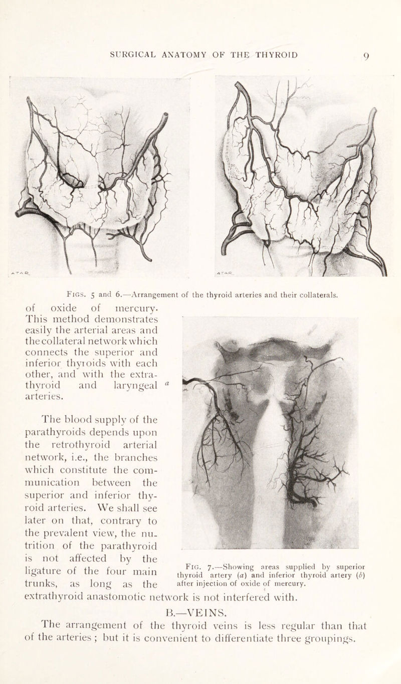 Figs. 5 and 6.—Arrangement of the thyroid arteries and their collaterals. of oxide of mercury. This method demonstrates easily the arterial areas and the collateral network which connects the superior and inferior thyroids with each other, and with the extra¬ thyroid and laryngeal arteries. The blood supply of the parathyroids depends upon the retrothvroid arterial network, i.e., the branches which constitute the com¬ munication between the superior and inferior thy¬ roid arteries. We shall see later on that, contrary to the prevalent view, the nu¬ trition of the parathyroid is not affected by the ligature of the four main trunks, as long as the extrathyroid anastomotic network is not interfered with. Fig. 7.—Showing areas supplied by superior thyroid artery (a) and inferior thyroid artery (Æ) after injection of oxide of mercury. B.—VEINS. The arrangement of the thyroid veins is less regular than that of the arteries ; but it is convenient to differentiate three groupings.