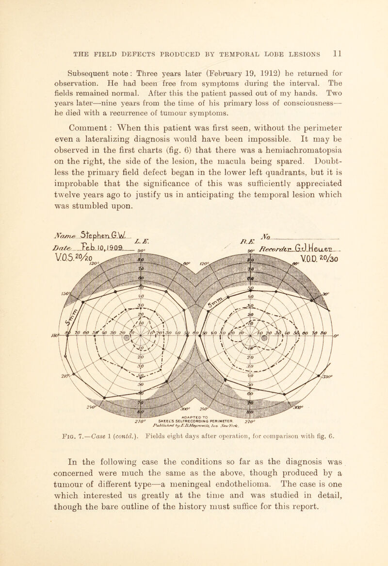 Subsequent note : Three years later (February 19, 1912) he returned for observation. He had been free from symptoms during the interval. The fields remained normal. After this the patient passed out of my hands. Two years later—nine years from the time of his primary loss of consciousness— he died with a recurrence of tumour symptoms. Comment : When this patient was first seen, without the perimeter even a lateralizing diagnosis would have been impossible. It may be observed in the first charts (fig. 6) that there was a hemiachromatopsia on the right, the side of the lesion, the macula being spared. Doubt¬ less the primary field defect began in the lower left quadrants, but it is improbable that the significance of this was sufficiently appreciated twelve years ago to justify us in anticipating the temporal lesion which was stumbled upon. Xa/n/i ._5tephen G.W- Date^ .....Teb, 10,1909,.. V0.5.20/£o A a Ji.K 90° ftecordLT!...S3SJJA 6ueu.. V.O.D. 2°/30 270° SKEEL'S SEIFRECORDING PERIMETER 210° F^ublUhed bi/£.h.Me4/rvtvitz> Jao .VewY?>rk. Fig. 7.— Case 1 (contcl.). Fields eight days after operation, for comparison with fig. 6. In the following case the conditions so far as the diagnosis was concerned were much the same as the above, though produced by a tumour of different type—a meningeal endothelioma. The case is one which interested us greatly at the time and was studied in detail, though the bare outline of the history must suffice for this report.