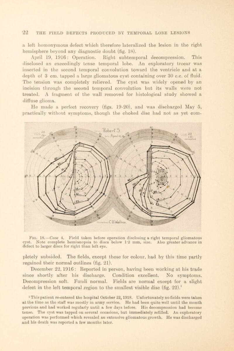 a left homonymous defect which therefore lateralized the lesion in the right hemisphere beyond any diagnostic doubt (fig. 18). April 19, 1916: Operation. Bight subtemporal decompression. This disclosed an exceedingly tense temporal lobe. An exploratory trocar was inserted in the second temporal convolution toward the ventricle and at a depth of 3 cm. tapped a large gliomatous cyst containing over 30 c.c. of fluid. The tension was completely relieved. The cyst was widely opened by an incision through the second temporal convolution but its walls were not treated. A fragment of the wall removed for histological study showed a diffuse glioma. He made a perfect recovery (figs. 19-20), and was discharged May 5, practically without symptoms, though the choked disc had not as yet com- Fig. 18. — Case 4. Field taken before operation disclosing a right temporal gliomatous •cyst. Note complete hemianopsia to discs below F2 mm. size. Also greater advance in defect to larger discs for right than left eye. pletely subsided. The fields, except those for colour, had by this time partly regained their normal outlines (fig. 21). December 22, 1916 : Beported in person, having been working at his trade since shortly after his discharge. Condition excellent. No symptoms. Decompression soft. Fundi normal. Fields are normal except for a slight defect in the left temporal region to the smallest visible disc (fig. 22).1 1 This patient re-entered the hospital October 22, 1918. Unfortunately no fields were taken at the time as the staff was mostly in army service. He had been quite well until the month previous and had worked regularly until a few days before. His decompression had become tense. The cyst was tapped on several occasions, but immediately refilled. An exploratory operation was performed which revealed an extensive gliomatous growth. He was discharged and his death was reported a few months later.