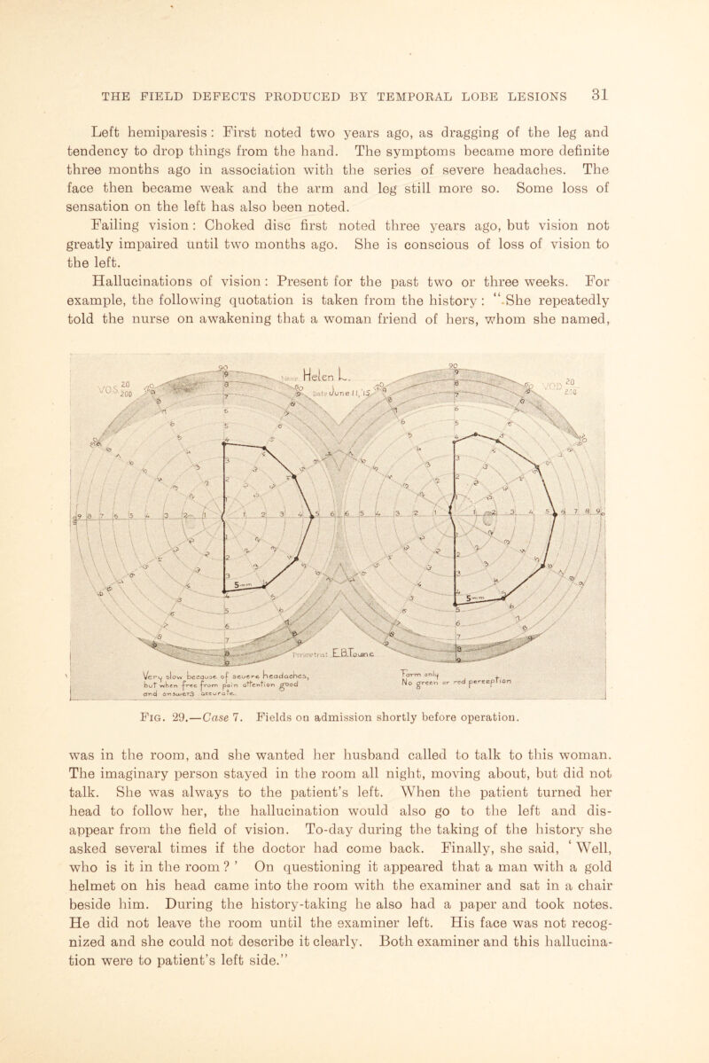 Left hemiparesis : First noted two years ago, as dragging of the leg and tendency to drop things from the hand. The symptoms became more definite three months ago in association with the series of severe headaches. The face then became weak and the arm and leg still more so. Some loss of sensation on the left has also been noted. Failing vision: Choked disc first noted three years ago, but vision not greatly impaired until two months ago. She is conscious of loss of vision to the left. Hallucinations of vision: Present for the past two or three weeks. For example, the following quotation is taken from the history : “.She repeatedly told the nurse on awakening that a woman friend of hers, whom she named, was in the room, and she wanted her husband called to talk to this woman. The imaginary person stayed in the room all night, moving about, but did not talk. She was always to the patient’s left. When the patient turned her head to follow her, the hallucination would also go to the left and dis¬ appear from the field of vision. To-day during the taking of the history she asked several times if the doctor had come back. Finally, she said, ‘ Well, who is it in the room ? ’ On questioning it appeared that a man with a gold helmet on his head came into the room with the examiner and sat in a chair beside him. During the history-taking he also had a paper and took notes. He did not leave the room until the examiner left. His face was not recog¬ nized and she could not describe it clearly. Both examiner and this hallucina¬ tion were to patient’s left side.”