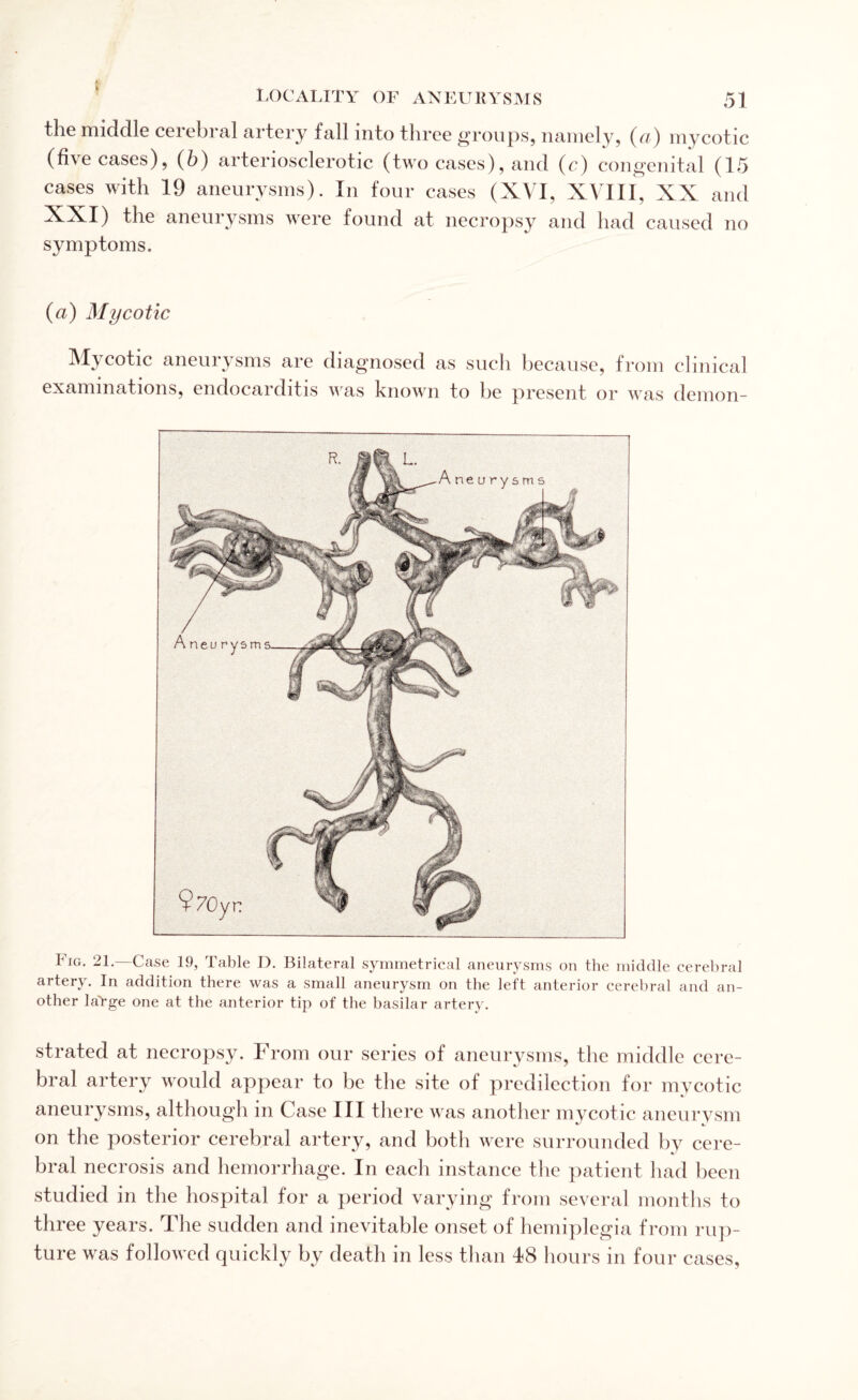 the middle cerebral artery fall into three groups, namely, (a) mycotic (five cases), (b) arteriosclerotic (two cases), and (c) congenital (15 cases with 19 aneurysms). In four cases (XVI, XVIII, XX and XXI) the aneurysms were found at necropsy and had caused no symptoms. (a) Mycotic Mycotic aneurysms are diagnosed as such because, from clinical examinations, endocarditis was known to be present or was demon- Iig. 21. Case 19, Table D. Bilateral symmetrical aneurysms on the middle cerebral artery. In addition there was a small aneurysm on the left anterior cerebral and an¬ other large one at the anterior tip of the basilar artery. strated at necropsy. From our series of aneurysms, the middle cere¬ bral artery would appear to be the site of predilection for mycotic aneurysms, although in Case III there was another mycotic aneurysm on the posterior cerebral artery, and both were surrounded by cere¬ bral necrosis and hemorrhage. In each instance the patient had been studied in the hospital for a period varying from several months to three years. The sudden and inevitable onset of hemiplegia from rup¬ ture was followed quickly by death in less than 48 hours in four cases,