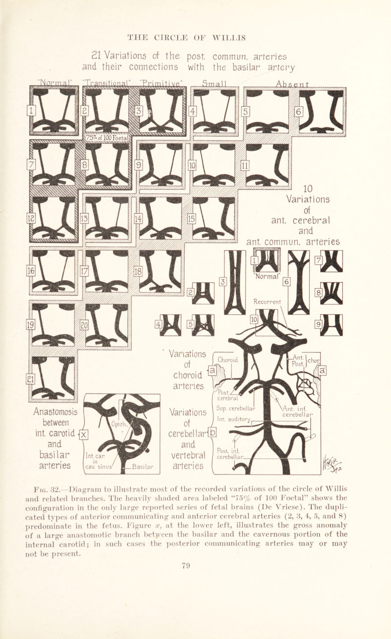 21 Variations of the post commun. arteries and their connections with the basilar artery ... 757° of 100 Foetal, Variations ant. cerebral and ant. commun. arteries Normal' Recurrent Variations choroid arteries r Post.Zl^r * cerebral Sup. cerebellar Int. auditory ^^77\77Zy/r'/Z ■Ant. inf. cerebellar Anastomosis between int. carotid and basilar arteries Variations cerebellarib and vertebral arteries Post. int. cerebellar. cav. emus' Fro. 32.—Diagram to illustrate most of the recorded variations of the circle of Willis and related branches. The heavily shaded area labeled “75% of 100 Foetal” shows the configuration in the only large reported series of fetal brains (De Vriese). The dupli¬ cated types of anterior communicating and anterior cerebral arteries (2, 3, 4, 5, and 8) predominate in the fetus. Figure x, at the lower left, illustrates the gross anomaly of a large anastomotic branch between the basilar and the cavernous portion of the internal carotid; in such cases the posterior communicating arteries may or may not be present.