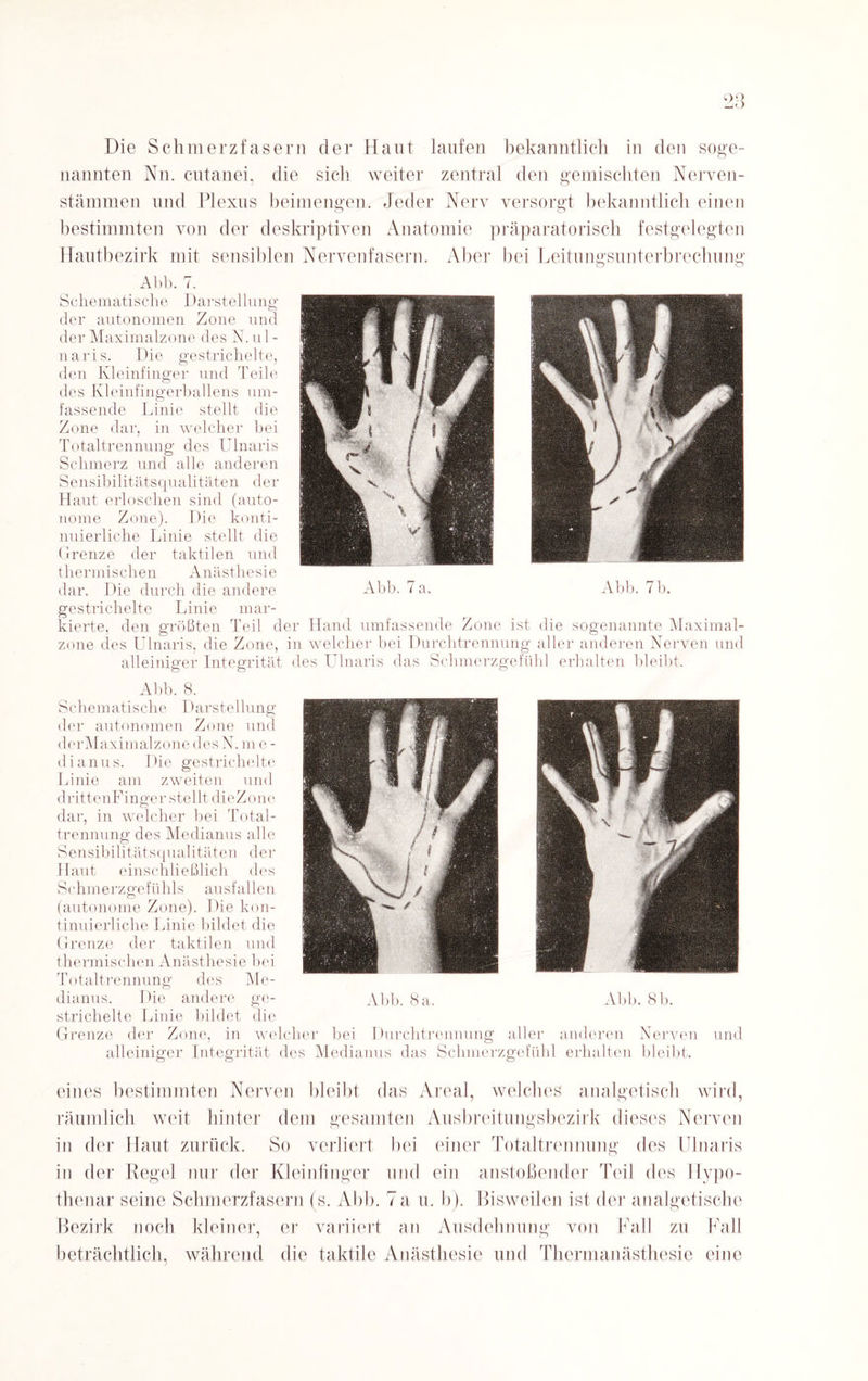 Die Schmerzfasern der Haut laufen bekanntlich in den soge¬ nannten Nn. cutanei, die sich weiter zentral den gemischten Nerven- stämmen und Plexus beimengen. Jeder Nerv versorgt bekanntlich einen bestimmten von der deskriptiven Anatomie präparatorisch festgelegten Hautbezirk mit sensiblen Nervenfasern. Aber bei Leitungsunterbrechung o o Abb. 7. Schematische Darstellung der autonomen Zone und der Maximalzone des N. u 1 - naris. Die gestrichelte, den Kleinfinger und des Kleinfingerballens um¬ fassende Linie stellt die Zone dar, in welcher bei Totaltrennung des Ulnaris Schmerz und alle anderen Sensibilitätsqualitäten der Haut erloschen sind (auto¬ nome Zone). Die konti¬ nuierliche Linie stellt die Grenze der taktilen und thermischen Anästhesie dar. Die durch die andere Abb. 7a. Abb. 7b. gestrichelte Linie mar¬ kierte, den größten Teil der Hand umfassende Zone ist die sogenannte Maximal¬ zone des Ulnaris, die Zone, in welcher bei Durchtrennung aller anderen Nerven und alleiniger Integrität des Ulnaris das Schmerzgefühl erhalten bleibt. Abb. 8. Sehern atische Darstellung der autonomen Zone und derMaximalzone des N. m e - dianus. Die gestrichelte Linie am zweiten und drittenFinger stellt clieZone dar, in welcher bei Total¬ trennung des Medianus alle Sensibilitätsqualitäten der Haut einschließlich des S c hmerzgef ühl s au sf allen (autonome Zone). Die kon¬ tinuierliche Linie bildet die Grenze der taktilen und thermischen Anästhesie bei Totaltrennung des Me¬ dianus. Die andere ge- Abb. 8 a. Abb. 8 b. strichelte Linie bildet die Grenze der Zone, in welcher bei Durchtrennung aller anderen Nerven und alleiniger Integrität des Medianus das Schmerzgefühl erhalten bleibt. eines bestimmten Nerven bleibt das Areal, welches analgetisch wird, räumlich weit hinter dem gesamten Ausbreitungsbezirk dieses Nerven in der Haut zurück. So verliert bei einer Totaltrennung des Ulnaris in der Regel nur der Kleinfinger und ein anstoßender Teil des Hypo- thenar seine Schmerzfasern (s. Abb. 7a u. b). Bisweilen ist der analgetische Bezirk noch kleiner, er variiert an Ausdehnung von Fall zu Fall beträchtlich, während die taktile Anästhesie und Thermanästhesie eine