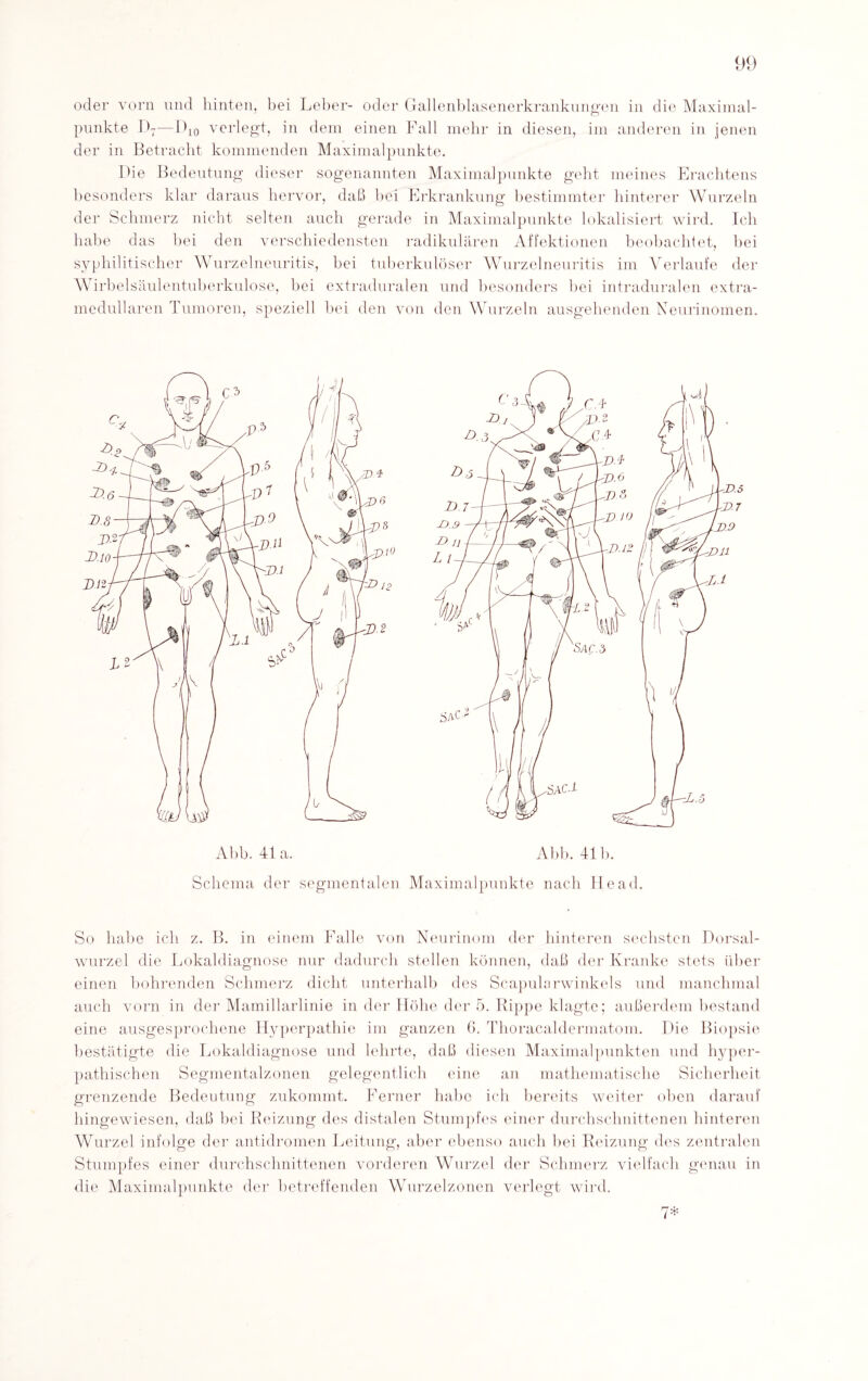 oder vorn und hinten, bei Leber- oder Gallenblasenerkrankungen in die Maximal¬ punkte I)7—D10 verlegt, in dem einen Fall mehr in diesen, im anderen in jenen der in Betracht kommenden Maximal punkte. Die Bedeutung dieser sogenannten Maximal punkte geht meines Erachtens besonders klar daraus hervor, daß bei Erkrankung bestimmter hinterer Wurzeln der Schmerz nicht selten auch gerade in Maximalpunkte lokalisiert wird. Ich habe das bei den verschiedensten radikulären Affektionen beobachtet, bei syphilitischer Wurzelneuritis, hei tuberkulöser Wurzelneuritis im Verlaufe der Wirbelsäulentuberkulose, bei extraduralen und besonders bei intraduralen extra¬ medullären Tumoren, speziell bei den von den Wurzeln ausgehenden Neurinomen. Abb. 41a. Abb. 41b. Schema der segmentalen Maximalpunkte nach He ad. So habe ich z. B. in einem Falle von Neurinom der hinteren sechsten Dorsal¬ wurzel die Lokaldiagnose nur dadurch stellen können, daß der Kranke stets über einen bohrenden Schmerz dicht unterhalb des Scapularwinkels und manchmal auch vorn in der Mamillarlinie in der Höhe der 5. Rippe klagte; außerdem bestand eine ausgesprochene Hyperpathie im ganzen 6. Thoracaldermatom. Die Biopsie bestätigte die Lokaldiagnose und lehrte, daß diesen Maximalpunkten und hyper- pathischen Segmentalzonen gelegentlich eine an mathematische Sicherheit grenzende Bedeutung zukommt. Ferner habe ich bereits weiter oben darauf hingewiesen, daß bei Reizung des distalen Stumpfes einer durchschnittenen hinteren Wurzel infolge der antidromen Leitung, aber ebenso auch bei Reizung des zentralen Stumpfes einer durchschnittenen vorderen Wurzel der Schmerz vielfach genau in die Maximalpunkte der betreffenden Wurzelzonen verlegt wird. 7*