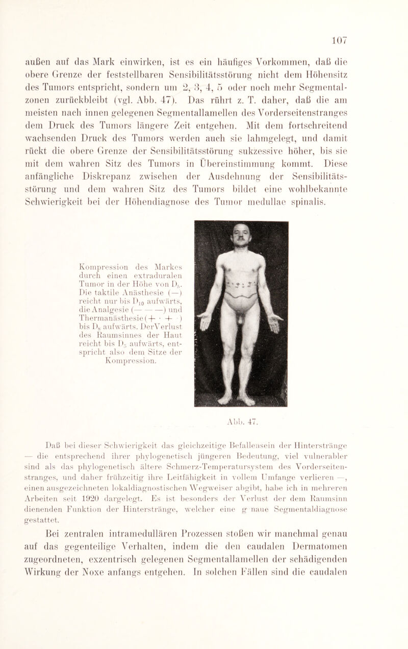 außen auf das Mark einwirken, ist es ein häufiges Vorkommen, daß die obere Grenze der feststellbaren Sensibilitätsstörung nicht dem Höhensitz des Tumors entspricht, sondern um 2, 3, 4, 5 oder noch mehr Segmental- zonen zurückbleibt (vgl. Abb. 47). Das rührt z. T. daher, daß die am meisten nach innen gelegenen Segmentallamellen des Vorderseitenstranges dem Druck des Tumors längere Zeit entgehen. Mit dem fortschreitend wachsenden Druck des Tumors werden auch sie lahmgelegt, und damit rückt die obere Grenze der Sensibilitätsstörung sukzessive höher, bis sie mit dem wahren Sitz des Tumors in Übereinstimmung kommt. Diese anfängliche Diskrepanz zwischen der Ausdehnung der Sensibilitäts¬ störung und dem wahren Sitz des Tumors bildet eine wohlbekannte Schwierigkeit bei der Höhendiagnose des Tumor medullae spinalis. Kompression des Markes durch einen extraduralen Tumor in der Höhe von kr. Die taktile Anästhesie (—) reicht nur bis D10 aufwärts, die Analgesie (-) und Thermanästhesie(-)- • 4- •) bis D8 aufwärts. DerVerlust des Raumsinnes der Haut reicht bis D5 aufwärts, ent¬ spricht also dem Sitze der Kompression. Abb. 47. Daß bei dieser Schwierigkeit das gleichzeitige Befallensein der Hinterstränge die entsprechend ihrer phylogenetisch jüngeren Bedeutung, viel vulnerabler sind als das phylogenetisch ältere Schmerz-Temperatursystem des Vorderseiten¬ stranges, und daher frühzeitig ihre Leitfähigkeit in vollem Umfange verlieren —, einen ausgezeichneten lokaldiagnostischen Wegweiser abgibt, habe ich in mehreren Arbeiten seit 1920 dargelegt. Es ist besonders der Verlust der dem Raumsinn dienenden Funktion der Hinterstränge, welcher eine g naue Segmentaldiagnose gestattet. Bei zentralen intramedullären Prozessen stoßen wir manchmal genau auf das gegenteilige Verhalten, indem die den caudalen Dermatomen zugeordneten, exzentrisch gelegenen Segmentallamellen der schädigenden Wirkung der Noxe anfangs entgehen. In solchen Fällen sind die caudalen