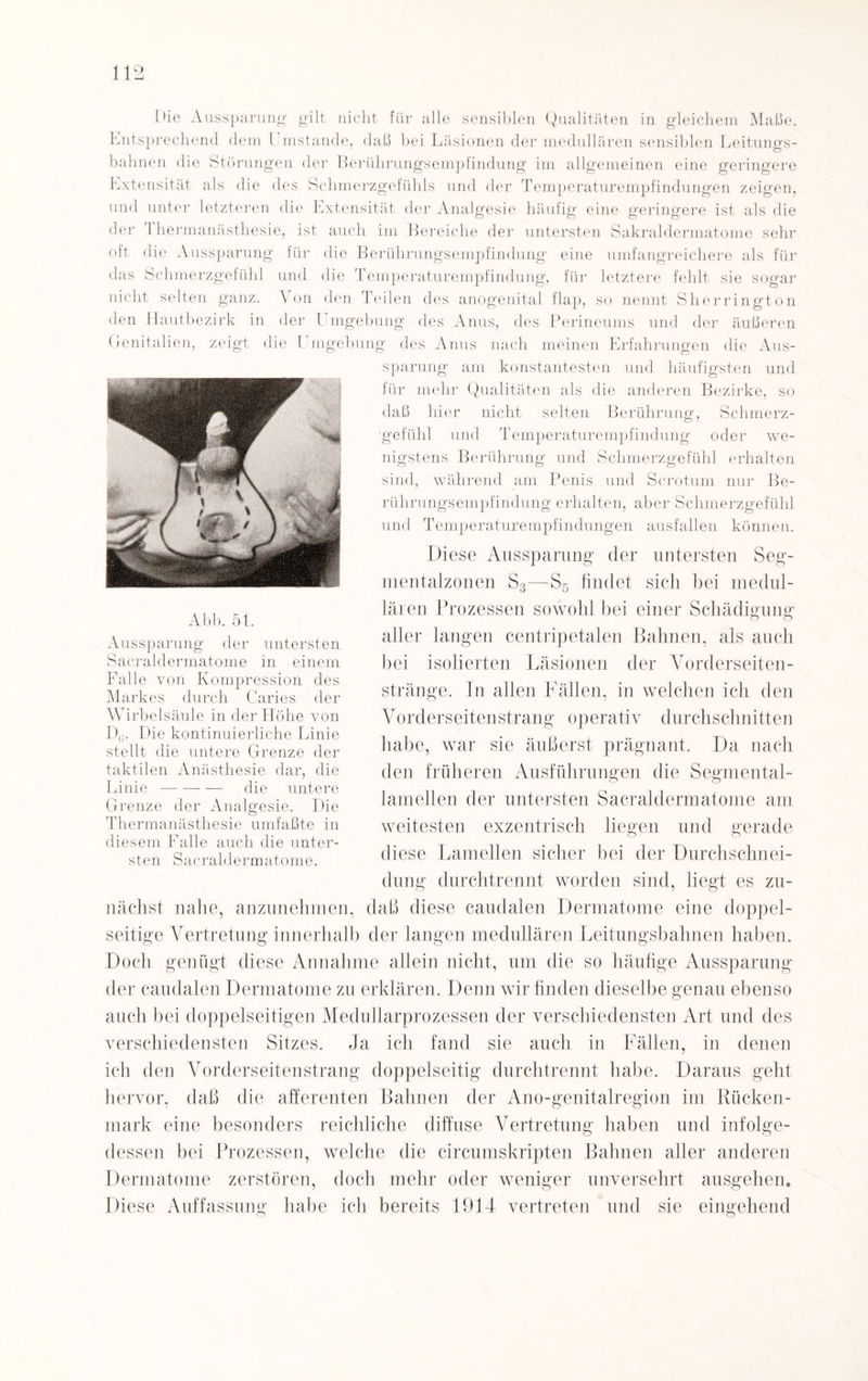 hie Aussparung gilt nicht für alle sensiblen Qualitäten in gleichem Maße. Entsprechend dem l mstande, daß bei Läsionen der medullären sensiblen Leitungs¬ bahnen die Störungen der Berührungsempfindung im allgemeinen eine geringere Extensität als die des Schmerzgefühls und der Temperaturempfindungen zeigen, und unter letzteren die Extensität der Analgesie häufig eine geringere ist als die der d hermanästhesie, ist auch im Bereiche der untersten Sakraldermatome sehr oft die Aussparung für die Berührungsempfindung eine umfangreichere als für das Schmerzgefühl und die Temperaturempfindung, für letztere fehlt sie sogar nicht selten ganz. Von den Teilen des anogenital flap, so nennt Sherrington den Hautbezirk in der Genitalien, Umgebung O des Anus, des Perineums und der zeigt die Umgebung des Anus nach meinen Erfahrungen Ö äußeren die Aus¬ sparung am konstantesten und häufigsten und für mehr Qualitäten als die anderen Bezirke, so daß hier nicht selten Berührung, Schmerz¬ gefühl und Temperaturempfindung oder we¬ nigstens Berührung und Schmerzgefühl erhalten sind, während am Penis und Scrotum nur Be¬ rührungsempfindung erhalten, aber Schmerzgefühl und Temperaturempfindungen ausfallen können. Diese Aussparung der untersten Seg- mentalzonen S3—S5 findet sich bei medul¬ lären Prozessen sowohl bei einer Schädigung aller langen centripetalen Bahnen, als auch bei isolierten Läsionen der Vorderseiten¬ stränge. In allen Fällen, in welchen icli den Vorderseitenstrang operativ durchschnitten habe, war sie äußerst prägnant. Da nach den früheren Ausführungen die Segmental- lamellen der untersten Sacraldermatome am weitesten exzentrisch liegen und gerade diese Lamellen sicher bei der Durchschnei- dung durchtrennt worden sind, liegt es zu¬ nächst nahe, anzunehmen, daß diese caudalen Dermatome eine doppel¬ seitige Vertretung innerhalb der langen medullären Leitungsbahnen haben. Doch genügt diese Annahme allein nicht, um die so häufige Aussparung der caudalen Dermatome zu erklären. Denn wir finden dieselbe genau ebenso auch bei doppelseitigen Medullarprozessen der verschiedensten Art und des verschiedensten Sitzes. Ja ich fand sie auch in Fällen, in denen ich den Vorderseitenstrang doppelseitig durchtrennt habe. Daraus geht hervor, daß die affereuten Bahnen der Ano-genitalregion im Rücken¬ mark eine besonders reichliche diffuse Vertretung haben und infolge¬ dessen bei Prozessen, welche die circumskripten Bahnen aller anderen Dermatome zerstören, doch mehr oder weniger unversehrt ausgehen. Diese Auffassung habe ich bereits 1914 vertreten und sie eingehend Abb. 5t. Aussparung der untersten Sacraldermatome in einem Falle von Kompression des Markes durch Caries der Wirbelsäule in der Höhe von D(>. Die kontinuierliche Linie stellt die untere Grenze der taktilen Anästhesie dar, die Linie-die untere Grenze der Analgesie. Die Thermanästhesie umfaßte in diesem Falle auch die unter¬ sten Sacraldermatome.