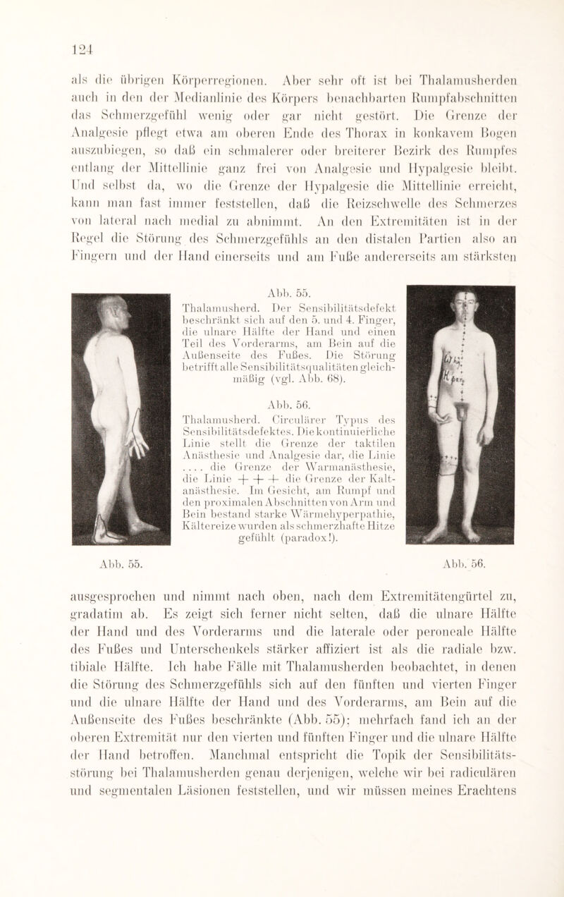 als die übrigen Körperregionen. Aber sehr oft ist bei Thalamusherden auch in den der Medianlinie des Körpers benachbarten Rumpfabschnitten das Schmerzgefühl wenig oder gar nicht gestört. Die Grenze der Analgesie pflegt etwa am oberen Ende des Thorax in konkavem Bogen auszubiegen, so daß ein schmalerer oder breiterer Bezirk des Rumpfes entlang der Mittellinie ganz frei von Analgesie und Hypalgesie bleibt. Und selbst da, wo die Grenze der Hypalgesie die Mittellinie erreicht, kann man fast immer feststellen, daß die Reizschwelle des Schmerzes von lateral nach medial zu abnimmt. An den Extremitäten ist in der Regel die Störung des Schmerzgefühls an den distalen Partien also an Fingern und der Hand einerseits und am Fuße andererseits am stärksten Abb. 55. Thalamusherd. Der Sensibilitätsdefekt beschränkt sich auf den 5. und 4. Finger, die ulnare Hälfte der Hand und einen Teil des Vorderarms, am Bein auf die Außenseite des Fußes. Die Störung betrifft alle Sensibilitätsqualitäten gleich¬ mäßig (vgl. Abb. 68). Abb. 56. Thalamusherd. Circulärer Typus des Sensibilitätsdefektes. Die kontinuierliche Linie stellt die Grenze der taktilen Anästhesie und Analgesie dar, die Linie . .. . die Grenze der Warmanästhesie, die Linie -j—|—I- die Grenze der Kalt¬ anästhesie. Iin Gesicht, am Rumpf und den proximalen Abschnitten von Arm und Bein bestand starke Wärmehyperpathie, Kältereize wurden als schmerzhafte Hitze gefühlt (paradox!). Abb. 55. Abb. 56. ausgesprochen und nimmt nach oben, nach dem Extremitätengürtel zu, gradatim ab. Es zeigt sich ferner nicht selten, daß die ulnare Hälfte der Hand und des Vorderarms und die laterale oder peroneale Hälfte des Fußes und Unterschenkels stärker affiziert ist als die radiale bzw. tibiale Hälfte. Ich habe Fälle mit Thalamusherden beobachtet, in denen die Störung des Schmerzgefühls sich auf den fünften und vierten Finger und die ulnare Hälfte der Hand und des Vorderarms, am Bein auf die Außenseite des Fußes beschränkte (Abb. 55); mehrfach fand ich an der oberen Extremität nur den vierten und fünften Finger und die ulnare Hälfte der Hand betroffen. Manchmal entspricht die Topik der Sensibilitäts¬ störung bei Thalamusherden genau derjenigen, welche wir bei radiculären und segmentalen Läsionen feststellen, und wir müssen meines Erachtens