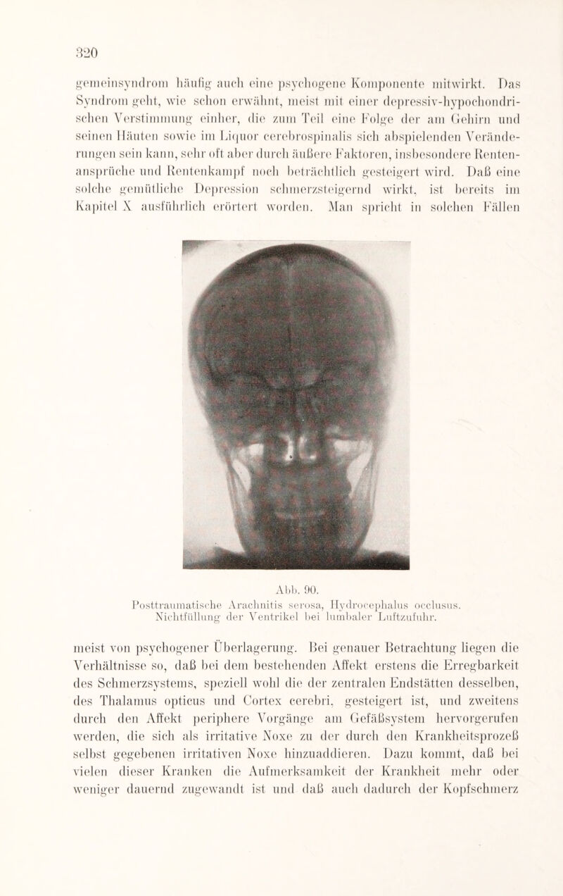 gemeinsyndrom häufig auch eine psychogene Komponente mitwirkt. T)as Syndrom geht, wie schon erwähnt, meist mit einer depressiv-hypochondri¬ schen Verstimmung einher, die zum Teil eine Folge der am Gehirn und seinen Häuten sowie im Liquor cerebrospinalis sich abspielenden Verände¬ rungen sein kann, sehr oft aber durch äußere Faktoren, insbesondere Renten¬ ansprüche und Rentenkampf noch beträchtlich gesteigert wird. Daß eine solche gemütliche Depression schmerzsteigernd wirkt, ist bereits im Kapitel X ausführlich erörtert worden. Man spricht in solchen Fällen Abb. 90. Posttraumatische Araclmitis serosa, Hydrocephalus occlusus. Nichtfüllung der Ventrikel bei lumbaler Luftzufuhr. meist von psychogener Überlagerung. Bei genauer Betrachtung liegen die Verhältnisse so, daß bei dem bestehenden Affekt erstens die Erregbarkeit des Schmerzsystems, speziell wohl die der zentralen Endstätten desselben, des Thalamus opticus und Cortex cerebri, gesteigert ist, und zweitens durch den Affekt periphere Vorgänge am Gefäßsystem hervorgerufen werden, die sich als irritative Noxe zu der durch den Krankheitsprozeß selbst gegebenen irritativen Noxe hinzuaddieren. Dazu kommt, daß bei vielen dieser Kranken die Aufmerksamkeit der Krankheit mehr oder weniger dauernd zugewandt ist und daß auch dadurch der Kopfschmerz