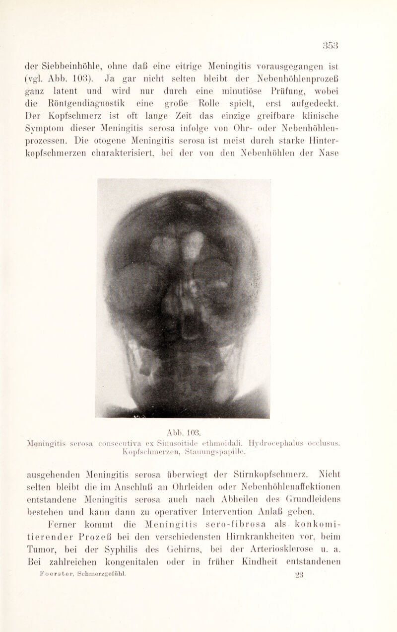 der Siebbeinhöhle, ohne daß eine eitrige Meningitis vorausgegangen ist (vgl. Abb. 103). Ja gar nicht selten bleibt der Nebenhöhlenprozeß ganz latent und wird nur durch eine minutiöse Prüfung, wobei die Röntgendiagnostik eine große Rolle spielt, erst aufgedeckt. Der Kopfschmerz ist oft lange Zeit das einzige greifbare klinische Symptom dieser Meningitis serosa infolge von Ohr- oder Nebenhöhlen¬ prozessen. Die otogene Meningitis serosa ist meist durch starke Hinter¬ kopfschmerzen charakterisiert, bei der von den Nebenhöhlen der Nase Abb. 103. Meningitis serosa consecotiva ex Sinusoitide etlimoidali. Hydrocephalus occlnsus. Kopfschmerzen, Stauungspapille. ausgehenden Meningitis serosa überwiegt der Stirnkopfschmerz. Nicht selten bleibt die im Anschluß an Ohrleiden oder Nebenhöhlenaffektionen entstandene Meningitis serosa auch nach Abheilen des Grundleidens bestehen und kann dann zu operativer Intervention Anlaß geben. Ferner kommt die Meningitis sero-fibrosa als konkomi- tierender Prozeß bei den verschiedensten Hirnkrankheiten vor, beim Tumor, bei der Syphilis des Gehirns, bei der Arteriosklerose u. a. Bei zahlreichen kongenitalen oder in früher Kindheit entstandenen Foerster, Schmerzgefühl. 23