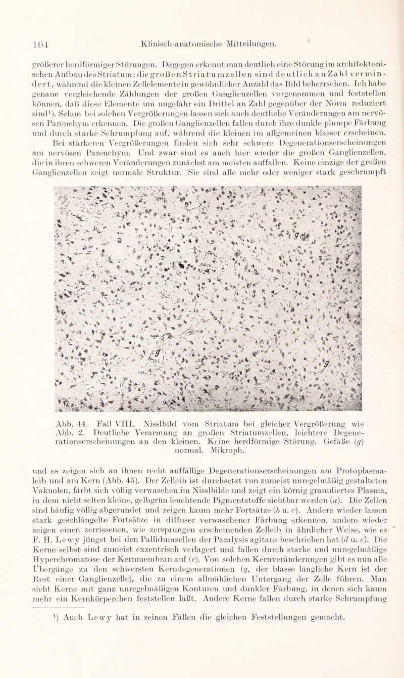 größerer herdförmiger Störungen. Dagegen erkennt man deutlich eine Störung im architektoni¬ schen Aufbau des Striatum: die g r o ß e n S t r i a t u m zellensi nd deutlich anZahlver min¬ dert, während die kleinen Zellelementein gewöhnlicher Anzahl das Bild beherrschen. Ich habe genaue vergleichende Zählungen der großen Ganglienzellen vorgenommen und feststellen können, daß diese Elemente um ungefähr ein Drittel an Zahl gegenüber der Norm reduziert sind1). Schon bei solchen Vergrößerungen lassen sich auch deutliche Veränderungen am nervö¬ sen Parenchym erkennen. Die großen Ganglienzellen fallen durch ihre dunkle plumpe Färbung und durch starke Schrumpfung auf, während die kleinen im allgemeinen blasser erscheinen. Bei stärkeren Vergrößerungen finden sich sehr schwere Degenerationserscheinungen am nervösen Parenchym. Und zwar sind es auch hier wieder die großen Ganglienzellen, die in ihren schweren Veränderungen zunächst am meisten auffallen. Keine einzige der großen Ganglienzellen zeigt normale Struktur. Sie sind alle mehr oder weniger stark geschrumpft m «m, * 1 ? ~ -5» V 'v'> * *$»* ■ * j-'v. .* ' »r *• u-Wt • V XL A\ ■ > l v. «L : > ' ‘ ' * ^ v * % iu « • . V- L . - V- . i,-; > $ ■ * * » H, * ' M ^ ‘ ' * W ' ‘T'-W - L ' ■ S ■ V* -St-*- \ - ' ; . », ^ * ■»., A'P ^ M, _ V. £ - v * • ■ * * ** L >1 U.rf*W-. S •*>. * Abb. 44. Fall VIII. Nisslbild vom Striatum bei gleicher Vergrößerung wie Abb. 2. Deutliche Verarmung an großen Striatumzellen, leichtere Degene¬ rationserscheinungen an den kleinen. Keine herdförmige Störung. Gefäße (g) normal. Mikroph. und es zeigen sich an ihnen recht auffällige Degenerationserscheinungen am Protoplasma¬ leib und am Kern (Abb. 45). Der Zelleib ist durchsetzt von zumeist unregelmäßig gestalteten Vakuolen, färbt sich völlig verwaschen im Nisslbilde und zeigt ein körnig granuliertes Plasma, in dem nicht selten kleine, gelbgrün leuchtende Pigmentstoffe sichtbar werden (a). Die Zellen sind häufig völlig abgerundet und zeigen kaum mehr Fortsätze (b u. c). Andere wieder lassen stark geschlängelte Fortsätze in diffuser verwaschener Färbung erkennen, andere wieder zeigen einen zerrissenen, wie zersprungen erscheinenden Zelleib in ähnlicher Weise, wie es F. H. L ewy jüngst bei den Pallidumzellen der Paralysis agitans beschrieben hat (d u. e). Die Kerne selbst sind zumeist exzentrisch verlagert und fallen durch starke und unregelmäßige Hyperchromatose der Kernmembran auf (e). Von solchen Kernveränderungen gibt es nun alle Übergänge zu den schwersten Kerndegenerationen (g, der blasse längliche Kern ist der Rest einer Ganglienzelle), die zu einem allmählichen Untergang der Zelle führen. Man sieht Kerne mit ganz unregelmäßigen Konturen und dunkler Färbung, in denen sich kaum mehr ein Kernkörperchen feststellen läßt. Andere Kerne fallen durch starke Schrumpfung J) Auch Lewy hat in seinen Fällen die gleichen Feststellungen gemacht.