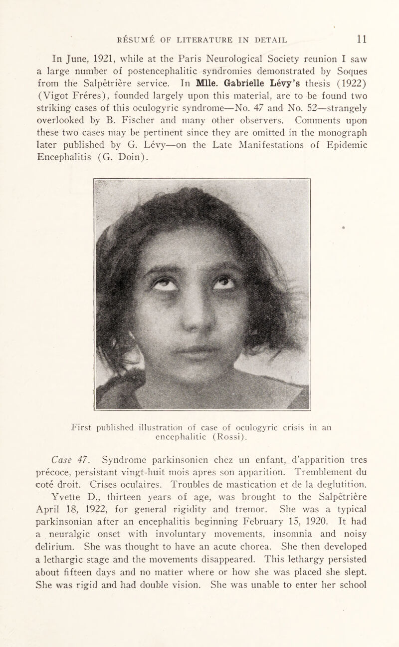 In June, 1921, while at the Paris Neurological Society reunion I saw a large number of postencephalitic syndromies demonstrated by Soques from the Salpetriere service. In Mile. Gabrielle Levy’s thesis (1922) (Vigot Freres), founded largely upon this material, are to be found two striking cases of this oculogyric syndrome—No. 47 and No. 52—strangely overlooked by B. Fischer and many other observers. Comments upon these two cases may be pertinent since they are omitted in the monograph later published by G. Levy—on the Late Manifestations of Epidemic Encephalitis (G. Doin). First published illustration of case of oculogyric crisis in an encephalitic (Rossi). Case 47. Syndrome parkinsonien chez un enfant, d’apparition tres precoce, persistant vingt-huit mois apres son apparition. Tremblement du cote droit. Crises oculaires. Troubles de mastication et de la deglutition. Yvette D., thirteen years of age, was brought to the Salpetriere April 18, 1922, for general rigidity and tremor. She was a typical parkinsonian after an encephalitis beginning February 15, 1920. It had a neuralgic onset with involuntary movements, insomnia and noisy delirium. She was thought to have an acute chorea. She then developed a lethargic stage and the movements disappeared. This lethargy persisted about fifteen days and no matter where or how she was placed she slept. She was rigid and had double vision. She was unable to enter her school