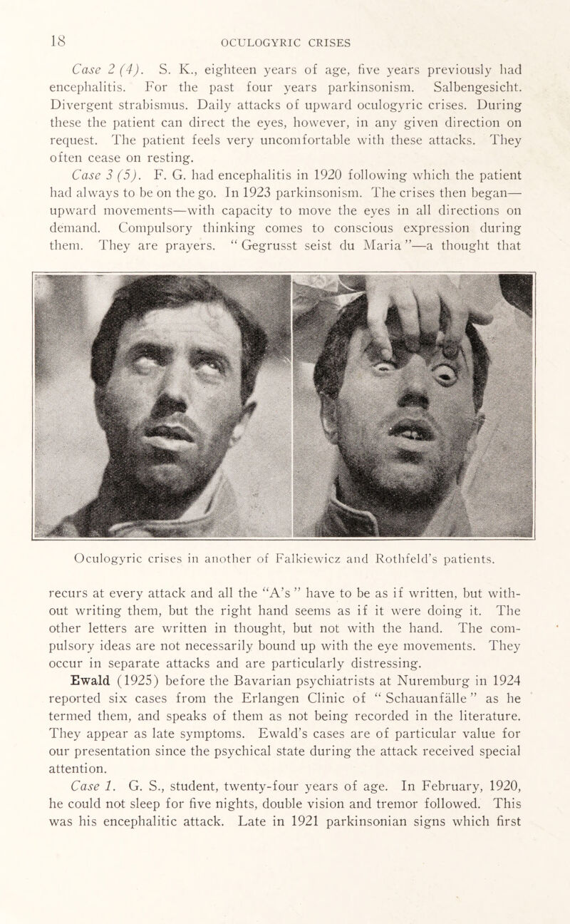 Case 2(4). S. K., eighteen years of age, five years previously had encephalitis. For the past four years parkinsonism. Salbengesicht. Divergent strabismus. Daily attacks of upward oculogyric crises. During these the patient can direct the eyes, however, in any given direction on request. The patient feels very uncomfortable with these attacks. They often cease on resting. Case 3(5). F. G. had encephalitis in 1920 following which the patient had always to be on the go. In 1923 parkinsonism. The crises then began— upward movements—with capacity to move the eyes in all directions on demand. Compulsory thinking comes to conscious expression during them. They are prayers. “ Gegrusst seist du Maria ”—a thought that Oculogyric crises in another of Falkiewicz and Rothfeld’s patients. recurs at every attack and all the “A’s ” have to be as if written, but with¬ out writing them, but the right hand seems as if it were doing it. The other letters are written in thought, but not with the hand. The com¬ pulsory ideas are not necessarily bound up with the eye movements. They occur in separate attacks and are particularly distressing. Ewald (1925) before the Bavarian psychiatrists at Nuremburg in 1924 reported six cases from the Erlangen Clinic of “ Schauanfalle ” as he termed them, and speaks of them as not being recorded in the literature. They appear as late symptoms. Ewald’s cases are of particular value for our presentation since the psychical state during the attack received special attention. Case 1. G. S., student, twenty-four years of age. In February, 1920, he could not sleep for five nights, double vision and tremor followed. This was his encephalitic attack. Late in 1921 parkinsonian signs which first