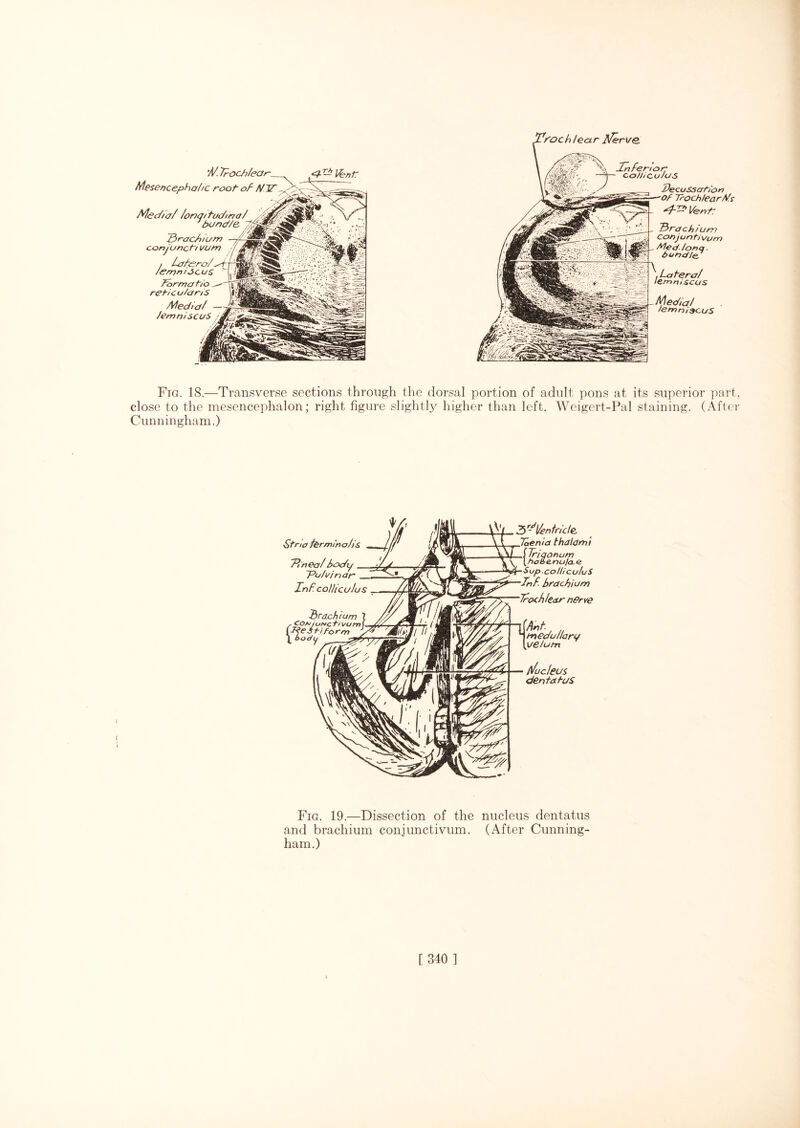 'ff. Troch/ear Mesencephalic root- of- NTT Media/ /onq/ fud/n a/ bund/e JDracfuum conjunct-/ vut /emmocus forma h/o reticularis Medid/ JemniscuS *d— l£nr j/n fenor colli cu Jus Decussation Trochlear Ms rfJd’ Vent: Tbrachium Cohjuntivum /or>q ■ bond/e, / -fera/ mscas Media/ lemniscus Fig. 18.—Transverse sections through the dorsal portion of adult pons at its superior part, close to the mesencephalon; right figure slightly higher than left. Weigert-Pal staining. (After Cunningham.) Stna termino/is 7~inea/ body ‘/d - ~Pufvin ar_ Inf colliculus brachium 1 rconjuNc ti vum I .dr- (DjeStiform } \'l S^/enlr/cle. Then!a thaIami Triqonum [haHenu/a.e Sup.colliculuS Inf- brachium Trochlear nerve ^ medullary velum f/uc/eus dentafaS Fig. 19.—Dissection of the nucleus dentatus and brachium conjunctivum. (After Cunning¬ ham.) k