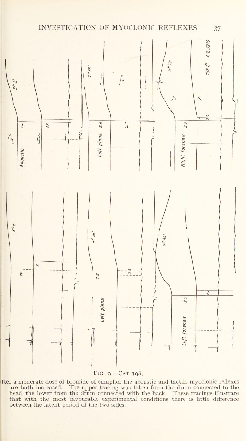 Fig. g—Cat 198. >fter a moderate dose of bromide of camphor the acoustic and tactile myoclonic reflexes are both increased. The upper tracing was taken from the drum connected to the head, the lower from the drum connected with the back. These tracings illustrate that with the most favourable experimental conditions there is little difference between the latent period of the two sides.