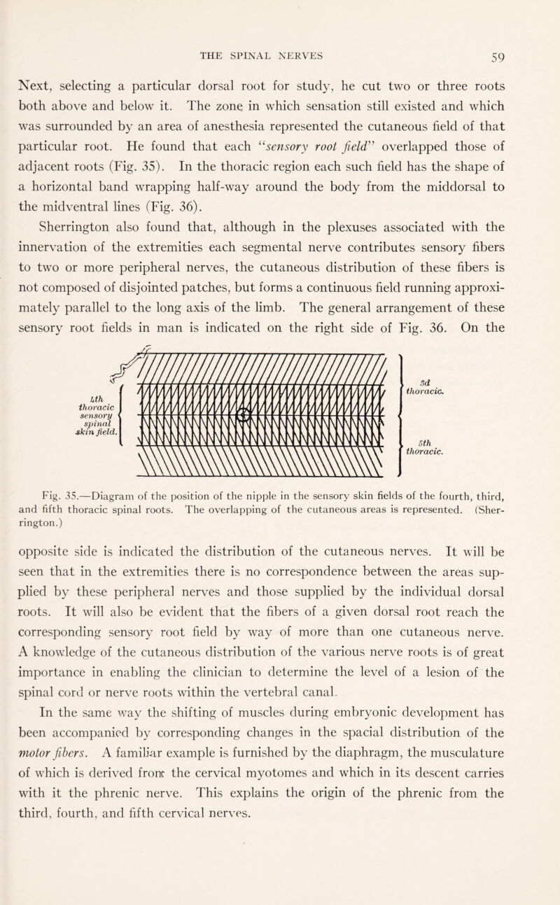 Next, selecting a particular dorsal root for study, he cut two or three roots both above and below it. The zone in which sensation still existed and which was surrounded by an area of anesthesia represented the cutaneous field of that particular root. He found that each “sensory root field” overlapped those of adjacent roots (Fig. 35). In the thoracic region each such field has the shape of a horizontal band wrapping half-way around the body from the middorsal to the midventral lines (Fig. 36). Sherrington also found that, although in the plexuses associated with the innervation of the extremities each segmental nerve contributes sensory fibers to two or more peripheral nerves, the cutaneous distribution of these fibers is not composed of disjointed patches, but forms a continuous field running approxi¬ mately parallel to the long axis of the limb. The general arrangement of these sensory root fields in man is indicated on the right side of Fig. 36. On the 3d thoracic. 5 th thoracic. Fig. 35.—Diagram of the position of the nipple in the sensory skin fields of the fourth, third, and fifth thoracic spinal roots. The overlapping of the cutaneous areas is represented. (Sher¬ rington.) opposite side is indicated the distribution of the cutaneous nerves. It will be seen that in the extremities there is no correspondence between the areas sup¬ plied by these peripheral nerves and those supplied by the individual dorsal roots. It will also be evident that the fibers of a given dorsal root reach the corresponding sensory root field by way of more than one cutaneous nerve. A knowledge of the cutaneous distribution of the various nerve roots is of great importance in enabling the clinician to determine the level of a lesion of the spinal cord or nerve roots within the vertebral canal. In the same way the shifting of muscles during embryonic development has been accompanied by corresponding changes in the spacial distribution of the motor fibers. A familiar example is furnished by the diaphragm , the musculature of which is derived fronc the cervical myotomes and which in its descent carries with it the phrenic nerve. This explains the origin of the phrenic from the third, fourth, and fifth cervical nerves. 4 th thoracic sensory spinal skin field. 7/III III/////UUII III mu III llh . ,\\\\\\\\\\VVV\\\\\\\V\V\\\\V { Pllllll