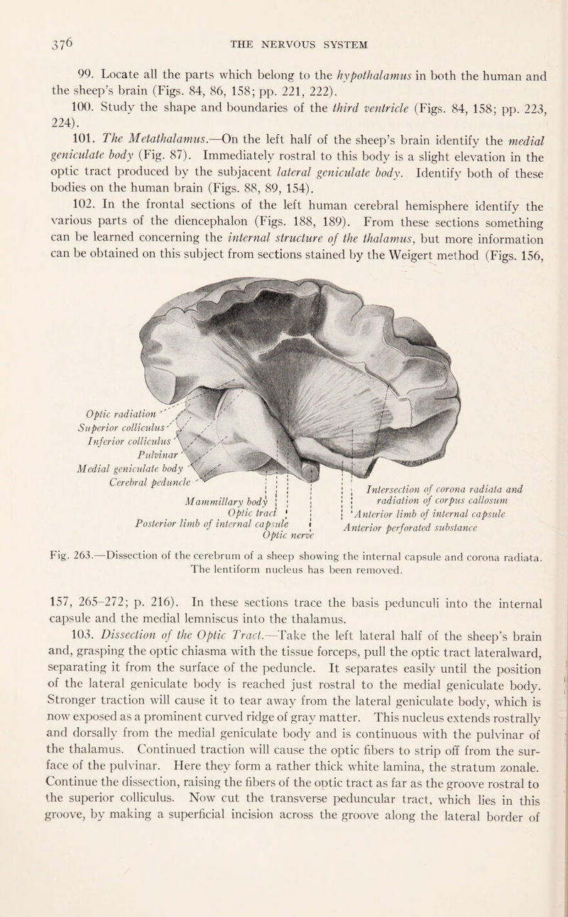 99. Locate all the parts which belong to the hypothalamus in both the human and the sheep’s brain (Figs. 84, 86, 158; pp. 221, 222). 100. Study the shape and boundaries of the third ventricle (Figs. 84, 158; pp. 223, 224). 101. The Metathalamus.—On the left half of the sheep’s brain identify the medial geniculate body (Fig. 87). Immediately rostral to this body is a slight elevation in the optic tract produced by the subjacent lateral geniculate body. Identify both of these bodies on the human brain (Figs. 88, 89, 154). 102. In the frontal sections of the left human cerebral hemisphere identify the various parts of the diencephalon (Figs. 188, 189). From these sections something can be learned concerning the internal structure of the thalamus, but more information can be obtained on this subject from sections stained by the Weigert method (Figs. 156, ; Intersection of corona radiata and ! radiation of corpus callosum j ‘ Anterior limb of internal capsule Anterior perforated substance Optic radiation Superior colliculus' Inferior colliculus Pulvinar Medial geniculate body Cerebral peduncle Mammillary body Optic tract Posterior limb of internal capsule Optic nerve Fig. 263.—Dissection of the cerebrum of a sheep showing the internal capsule and corona radiata. The lentiform nucleus has been removed. 157, 265-272; p. 216). In these sections trace the basis pedunculi into the internal capsule and the medial lemniscus into the thalamus. 103. Dissection of the Optic Tract.—Take the left lateral half of the sheep’s brain and, grasping the optic chiasma with the tissue forceps, pull the optic tract lateralward, separating it from the surface of the peduncle. It separates easily until the position of the lateral geniculate body is reached just rostral to the medial geniculate body. Stronger traction will cause it to tear away from the lateral geniculate body, which is now exposed as a prominent curved ridge of gray matter. This nucleus extends rostrally and dorsally from the medial geniculate body and is continuous with the pulvinar of the thalamus. Continued traction will cause the optic fibers to strip off from the sur¬ face of the pulvinar. Here they form a rather thick white lamina, the stratum zonale. Continue the dissection, raising the fibers of the optic tract as far as the groove rostral to the superior colliculus. Now cut the transverse peduncular tract, which lies in this groove, by making a superficial incision across the groove along the lateral border of