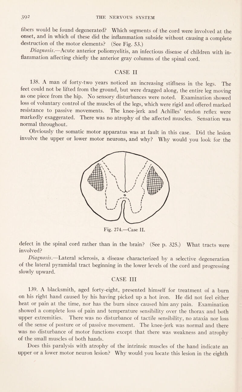 fibers would be found degenerated? Which segments of the cord were involved at the onset, and in which of these did the inflammation subside without causing a complete destruction of the motor elements? (See Fig. 53.) Diagnosis—Acute anterior poliomyelitis, an infectious disease of children with in¬ flammation affecting chiefly the anterior gray columns of the spinal cord. CASE II 138. A man of forty-two years noticed an increasing stiffness in the legs. The feet could not be lifted from the ground, but were dragged along, the entire leg moving as one piece from the hip. No sensory disturbances were noted. Examination showed loss of voluntary control of the muscles of the legs, which were rigid and offered marked resistance to passive movements. The knee-jerk and Achilles’ tendon reflex were markedly exaggerated. There was no atrophy of the affected muscles. Sensation was normal throughout. Obviously the somatic motor apparatus was at fault in this case. Did the lesion involve the upper or lower motor neurons, and why? Why would you look for the Fig. 274.—Case II. defect in the spinal cord rather than in the brain? (See p. 325.) What tracts were involved? Diagnosis.—Lateral sclerosis, a disease characterized by a selective degeneration of the lateral pyramidal tract beginning in the lower levels of the cord and progressing slowly upward. CASE III 139. A blacksmith, aged forty-eight, presented himself for treatment of a burn on his right hand caused by his having picked up a hot iron. He did not feel either heat or pain at the time, nor has the burn since caused him any pain. Examination showed a complete loss of pain and temperature sensibility over the thorax and both upper extremities. There was no disturbance of tactile sensibility, no ataxia nor loss of the sense of posture or of passive movement. The knee-jerk was normal and there was no disturbance of motor functions except that there was weakness and atrophy of the small muscles of both hands. Does this paralysis with atrophy of the intrinsic muscles of the hand indicate an upper or a lower motor neuron lesion? Why would you locate this lesion in the eighth