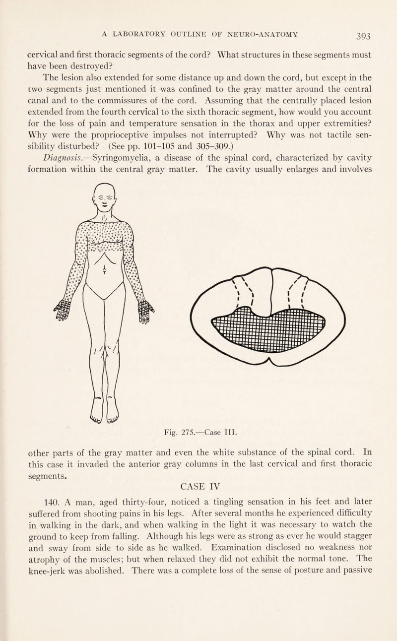 cervical and first thoracic segments of the cord? What structures in these segments must have been destroyed? The lesion also extended for some distance up and down the cord, but except in the two segments just mentioned it was confined to the gray matter around the central canal and to the commissures of the cord. Assuming that the centrally placed lesion extended from the fourth cervical to the sixth thoracic segment, how would you account for the loss of pain and temperature sensation in the thorax and upper extremities? Why were the proprioceptive impulses not interrupted? Why was not tactile sen¬ sibility disturbed? (See pp. 101-105 and 305-309.) Diagnosis.—Syringomyelia, a disease of the spinal cord, characterized by cavity formation within the central gray matter. The cavity usually enlarges and involves Fig. 275.—Case III. other parts of the gray matter and even the white substance of the spinal cord. In this case it invaded the anterior gray columns in the last cervical and first thoracic segments. CASE IV 140. A man, aged thirty-four, noticed a tingling sensation in his feet and later suffered from shooting pains in his legs. After several months he experienced difficulty in walking in the dark, and when walking in the light it was necessary to watch the ground to keep from falling. Although his legs were as strong as ever he would stagger and sway from side to side as he walked. Examination disclosed no weakness nor atrophy of the muscles; but when relaxed they did not exhibit the normal tone. The knee-jerk was abolished. There was a complete loss of the sense of posture and passive