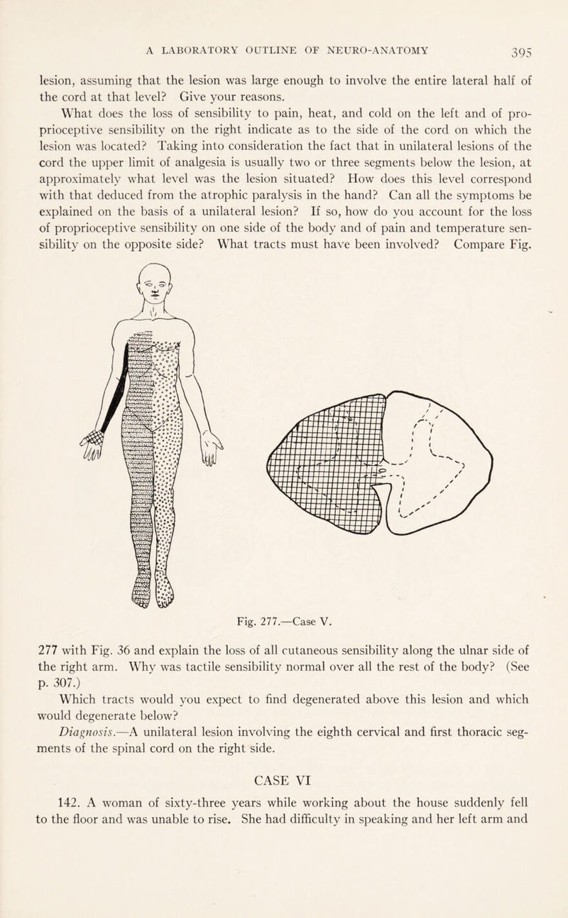 lesion, assuming that the lesion was large enough to involve the entire lateral half of the cord at that level? Give your reasons. What does the loss of sensibility to pain, heat, and cold on the left and of pro¬ prioceptive sensibility on the right indicate as to the side of the cord on which the lesion was located? Taking into consideration the fact that in unilateral lesions of the cord the upper limit of analgesia is usually two or three segments below the lesion, at approximately what level was the lesion situated? How does this level correspond with that deduced from the atrophic paralysis in the hand? Can all the symptoms be explained on the basis of a unilateral lesion? If so, how do you account for the loss of proprioceptive sensibility on one side of the body and of pain and temperature sen¬ sibility on the opposite side? What tracts must have been involved? Compare Fig. Fig. 277.—Case V. 277 with Fig. 36 and explain the loss of all cutaneous sensibility along the ulnar side of the right arm. Why was tactile sensibility normal over all the rest of the body? (See p. 307.) Which tracts would you expect to find degenerated above this lesion and which would degenerate below? Diagnosis.—A unilateral lesion involving the eighth cervical and first thoracic seg¬ ments of the spinal cord on the right side. CASE VI 142. A woman of sixty-three years while working about the house suddenly fell to the floor and was unable to rise. She had difficulty in speaking and her left arm and