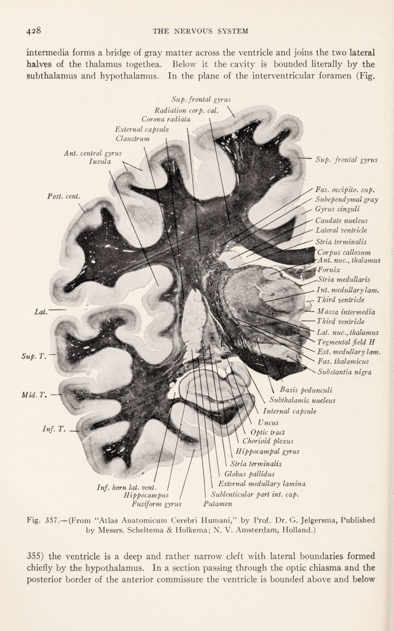 intermedia forms a bridge of gray matter across the ventricle and joins the two lateral halves of the thalamus togethea. Below it the cavity is bounded literally by the subthalamus and hypothalamus. In the plane of the interventricular foramen (Fig. Sup. frontal gyrus Sup. frontal gyrus Radiation corp. cal. Corona radiata External capsule Claustrum Ant. central gyrus Insula Post. cent. Fas. occipito. sup. Subependymal gray Gyrus cinguli Caudate nucleus Lateral ventricle Stria terminalis Corpus callosum nt. nuc., thalamus tria medullaris Int. medullary lam. Third ventricle M ass a intermedia Third ventricle Lai. nuc., thalamus Tegmental field II Ext. medullary lam. Fas. thalamicus Substantia nigra Basis pedunculi Subthalamic nucleus Internal capsule TJ ncus Optic tract Chorioid plexus Hippocampal gyrus Stria terminalis Globus pallidus External medullary lamina Sublenticular part int. cap. Putamen Lai. Sup. T. Mid. 7\ Inf. horn lat. vent. Hippocampus Fusiform gyrus Fig. 357.—(From “Atlas Anatomicum Cerebri Humani,” by Prof. Dr. G. Jelgersma, Published by Messrs. Scheltema & Holkema; N. V. Amsterdam, Holland.) 355) the ventricle is a deep and rather narrow cleft with lateral boundaries formed chiefly by the hypothalamus. In a section passing through the optic chiasma and the posterior border of the anterior commissure the ventricle is bounded above and below