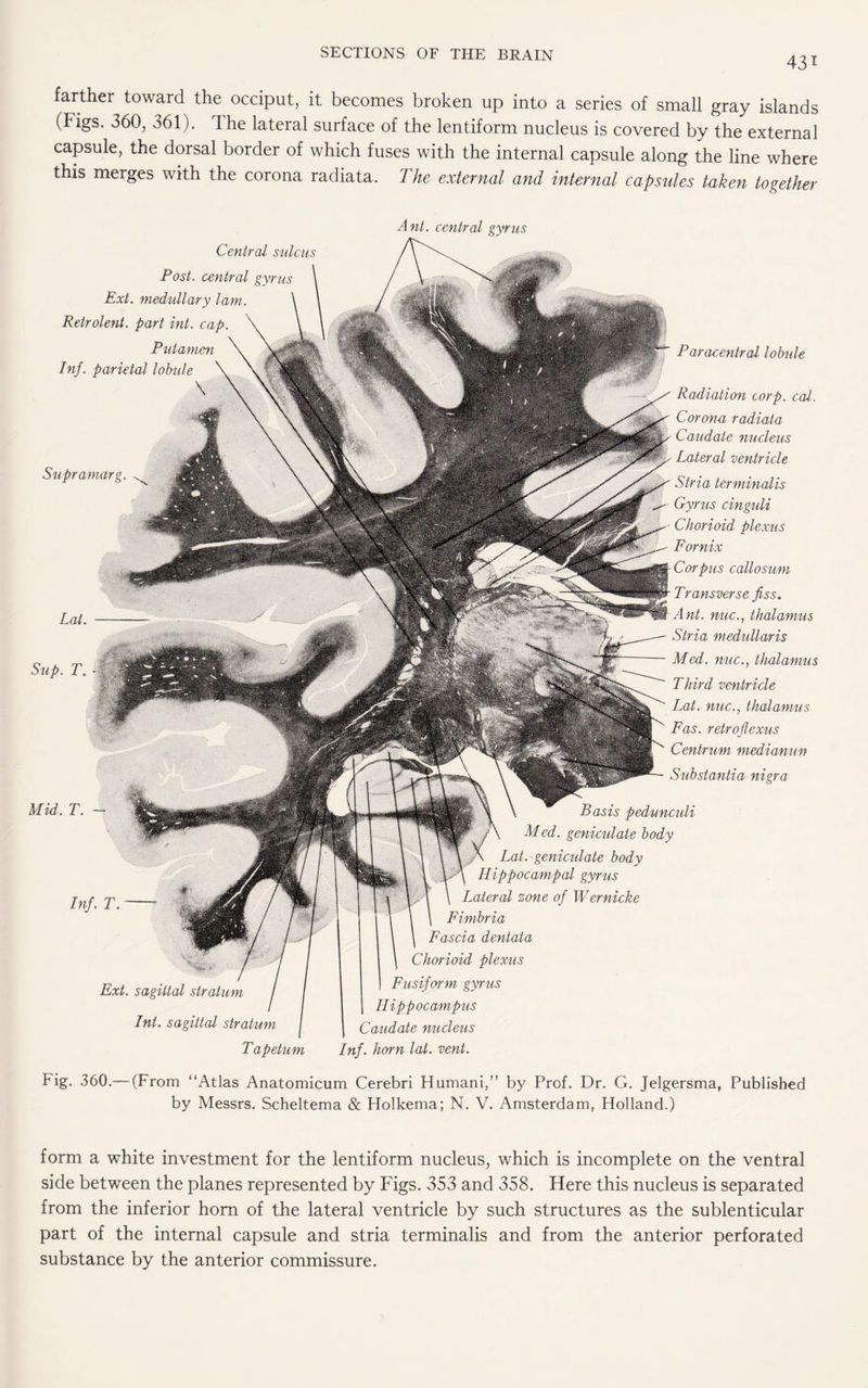 431 farther toward the occiput, it becomes broken up into a series of small gray islands (Figs. 360, 361). The lateral surface of the lentiform nucleus is covered by the external capsule, the dorsal border of which fuses with the internal capsule along the line where this merges with the corona radiata. The external and internal capsules taken together Ant. central gyrus Paracentral lobule Radiation corp. cal. Corona radiata Caudate nucleus Lateral ventricle Stria terminalis Gyrus cinguli Chorioid plexus Fornix Corpus callosum Transverse piss. Ant. nuc., thalamus Stria medullaris Med. nuc., thalamus Third ventricle Lat. nuc., thalamus Fas. retrojlexus Centrum medianun Substantia nigra Central sulcus Post, central gyrus Ext. medullary lam. Retrolent. part int. cap. Put amen Inf. parietal lobule \ Supramarg. Inf. T.- Ext. sagittal stratum Int. sagittal stratum T apetum nasis peaunci< Med. genicidate body Lat. genicidate body IIippocampal gyrus Lateral zone of Wernicke Fimbria Fascia dentala j Chorioid plexus Fusiform gyrus Hippocampus Caudate nucleus Inf. horn lat. vent. Lat. Sup. T. Mid. T. - tig. 360.— (From “Atlas Anatomicum Cerebri Humani,” by Prof. Dr. G. Jelgersma, Published by Messrs. Scheltema & Holkema; N. V. Amsterdam, Holland.) form a white investment for the lentiform nucleus, which is incomplete on the ventral side between the planes represented by Figs. 353 and 358. Here this nucleus is separated from the inferior horn of the lateral ventricle by such structures as the sublenticular part of the internal capsule and stria terminalis and from the anterior perforated substance by the anterior commissure.