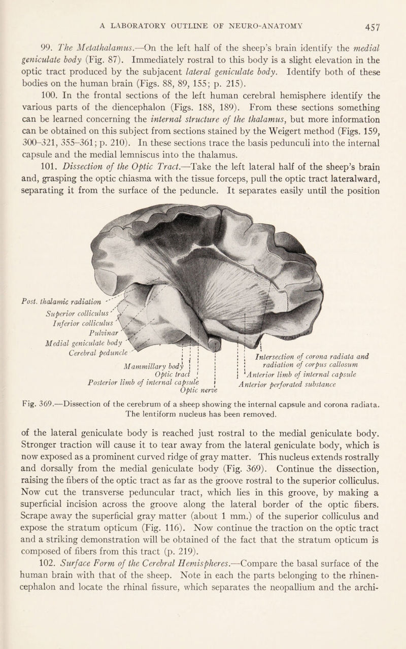 99. The Metathalamus.—On the left half of the sheep’s brain identify the medial geniculate body (Fig. 87). Immediately rostral to this body is a slight elevation in the optic tract produced by the subjacent lateral geniculate body. Identify both of these bodies on the human brain (Figs. 88, 89, 155; p. 215). 100. In the frontal sections of the left human cerebral hemisphere identify the various parts of the diencephalon (Figs. 188, 189). From these sections something can be learned concerning the internal structure of the thalamus, but more information can be obtained on this subject from sections stained by the Weigert method (Figs. 159, 300-321, 355-361; p. 210). In these sections trace the basis pedunculi into the internal capsule and the medial lemniscus into the thalamus. 101. Dissection of the Optic Tract.—lake the left lateral half of the sheep’s brain and, grasping the optic chiasma with the tissue forceps, pull the optic tract lateralward, separating it from the surface of the peduncle. It separates easily until the position Post. thalamic radiation Superior collicidus' Inferior collicidus Pulvinar Medial geniculate body Cerebral peduncle Mammillary body i j j Optic tract j Posterior limb of internal capsule » Optic nerve Intersection of corona radiata and radiation of corpus callosum } * Anterior limb of internal capsule Anterior perforated substance Fig. 369.—Dissection of the cerebrum of a sheep showing the internal capsule and corona radiata. The lentiform nucleus has been removed. of the lateral geniculate body is reached just rostral to the medial geniculate body. Stronger traction will cause it to tear away from the lateral geniculate body, which is now exposed as a prominent curved ridge of gray matter. This nucleus extends rostrally and dorsally from the medial geniculate body (Fig. 369). Continue the dissection, raising the fibers of the optic tract as far as the groove rostral to the superior colliculus. Now cut the transverse peduncular tract, which lies in this groove, by making a superficial incision across the groove along the lateral border of the optic fibers. Scrape away the superficial gray matter (about 1 mm.) of the superior colliculus and expose the stratum opticum (Fig. 116). Now continue the traction on the optic tract and a striking demonstration will be obtained of the fact that the stratum opticum is composed of fibers from this tract (p. 219). 102. Surface Form of the Cerebral Hemispheres.—Compare the basal surface of the human brain with that of the sheep. Note in each the parts belonging to the rhinen- cephalon and locate the rhinal fissure, which separates the neopallium and the archi-