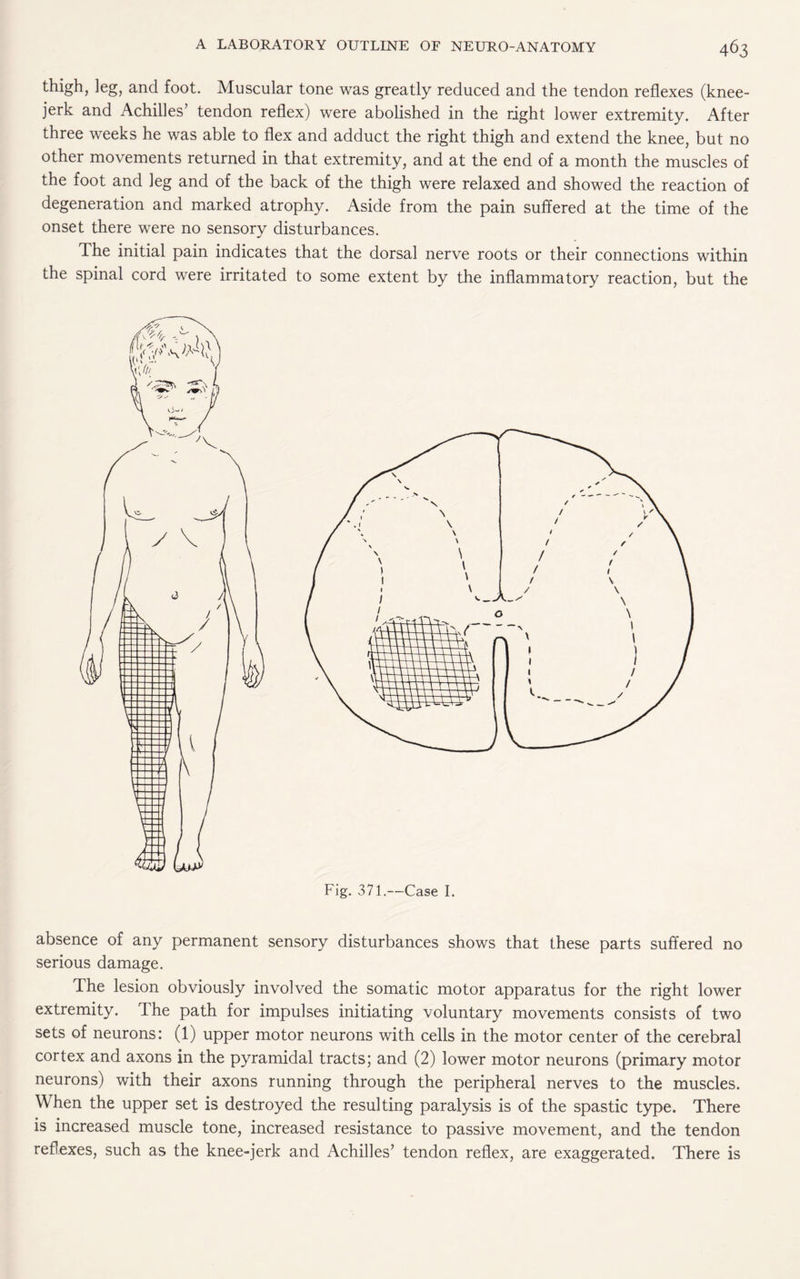 thigh, leg, and foot. Muscular tone was greatly reduced and the tendon reflexes (knee- jerk and Achilles’ tendon reflex) were abolished in the right lower extremity. After three weeks he was able to flex and adduct the right thigh and extend the knee, but no other movements returned in that extremity, and at the end of a month the muscles of the foot and leg and of the back of the thigh were relaxed and showed the reaction of degeneration and marked atrophy. Aside from the pain suffered at the time of the onset there were no sensory disturbances. The initial pain indicates that the dorsal nerve roots or their connections within the spinal cord were irritated to some extent by the inflammatory reaction, but the absence of any permanent sensory disturbances shows that these parts suffered no serious damage. The lesion obviously involved the somatic motor apparatus for the right lower extremity. The path for impulses initiating voluntary movements consists of two sets of neurons: (1) upper motor neurons with cells in the motor center of the cerebral cortex and axons in the pyramidal tracts; and (2) lower motor neurons (primary motor neurons) with their axons running through the peripheral nerves to the muscles. When the upper set is destroyed the resulting paralysis is of the spastic type. There is increased muscle tone, increased resistance to passive movement, and the tendon reflexes, such as the knee-jerk and Achilles’ tendon reflex, are exaggerated. There is