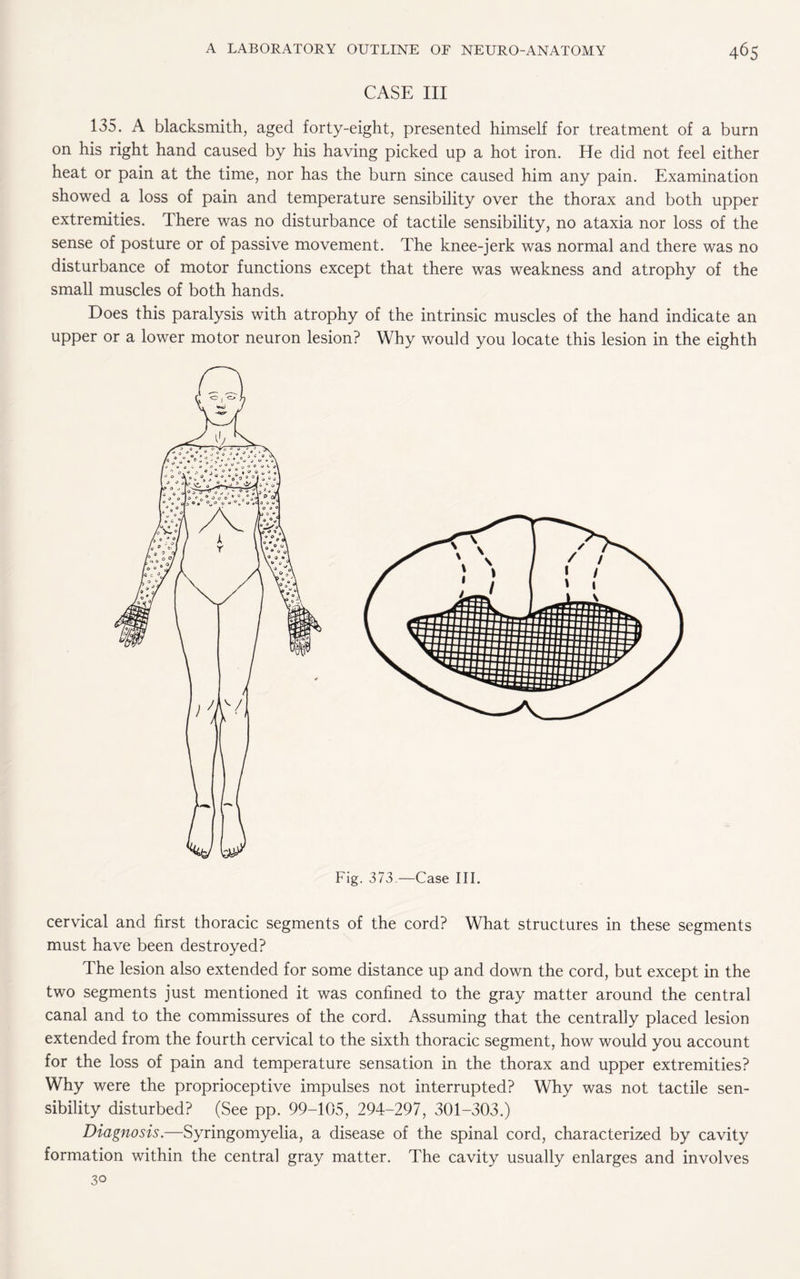 CASE III 135. A blacksmith, aged forty-eight, presented himself for treatment of a burn on his right hand caused by his having picked up a hot iron. He did not feel either heat or pain at the time, nor has the burn since caused him any pain. Examination showed a loss of pain and temperature sensibility over the thorax and both upper extremities. There was no disturbance of tactile sensibility, no ataxia nor loss of the sense of posture or of passive movement. The knee-jerk was normal and there was no disturbance of motor functions except that there was weakness and atrophy of the small muscles of both hands. Does this paralysis with atrophy of the intrinsic muscles of the hand indicate an upper or a lower motor neuron lesion? Why would you locate this lesion in the eighth Fig. 373 —Case III. cervical and first thoracic segments of the cord? What structures in these segments must have been destroyed? The lesion also extended for some distance up and down the cord, but except in the two segments just mentioned it was confined to the gray matter around the central canal and to the commissures of the cord. Assuming that the centrally placed lesion extended from the fourth cervical to the sixth thoracic segment, how would you account for the loss of pain and temperature sensation in the thorax and upper extremities? Why were the proprioceptive impulses not interrupted? Why was not tactile sen¬ sibility disturbed? (See pp. 99-105, 294-297, 301-303.) Diagnosis.—Syringomyelia, a disease of the spinal cord, characterized by cavity formation within the central gray matter. The cavity usually enlarges and involves 30