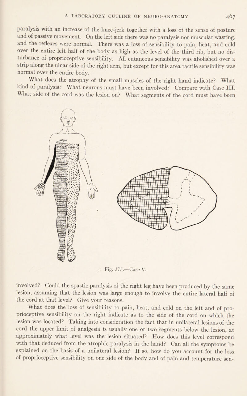 paralysis with an increase of the knee-jerk together with a loss of the sense of posture and of passive movement. On the left side there was no paralysis nor muscular wasting, and the reflexes were normal. There was a loss of sensibility to pain, heat, and cold over the entire left half of the body as high as the level of the third rib, but no dis¬ turbance of proprioceptive sensibility. All cutaneous sensibility was abolished over a strip along the ulnar side of the right arm, but except for this area tactile sensibility was normal over the entire body. What does the atrophy of the small muscles of the right hand indicate? What kind of paralysis? What neurons must have been involved? Compare with Case III. What side of the cord was the lesion on? What segments of the cord must have been Fig. 375.—Case V. involved? Could the spastic paralysis of the right leg have been produced by the same lesion, assuming that the lesion was large enough to involve the entire lateral half of the cord at that level? Give your reasons. What does the loss of sensibility to pain, heat, and cold on the left and of pro¬ prioceptive sensibility on the right indicate as to the side of the cord on which the lesion was located? Taking into consideration the fact that in unilateral lesions of the cord the upper limit of analgesia is usually one or two segments below the lesion, at approximately what level was the lesion situated? How does this level correspond with that deduced from the atrophic paralysis in the hand? Can all the symptoms be explained on the basis of a unilateral lesion? If so, how do you account for the loss of proprioceptive sensibility on one side of the body and of pain and temperature sen-