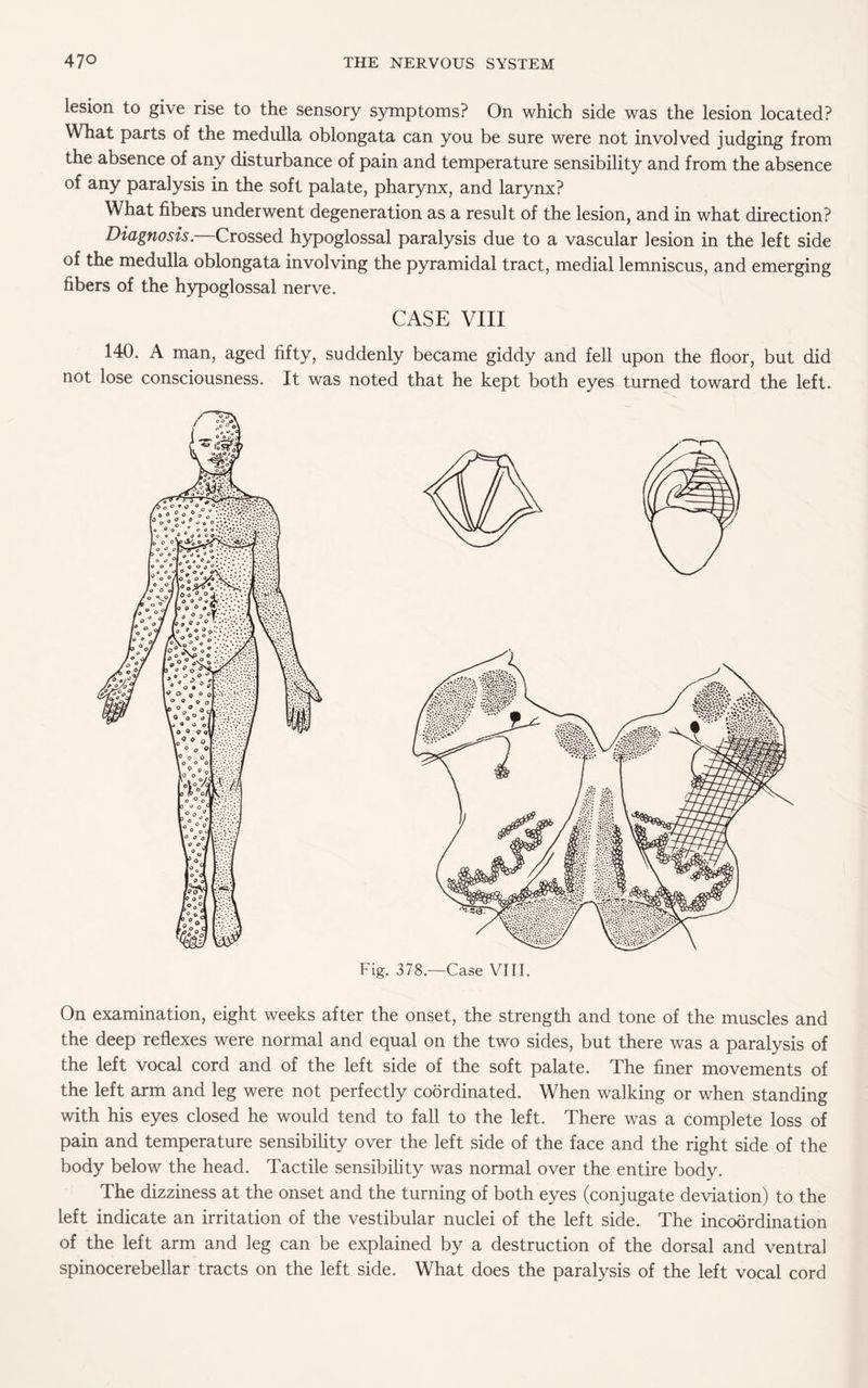 lesion to give rise to the sensory symptoms? On which side was the lesion located? What parts of the medulla oblongata can you be sure were not involved judging from the absence of any disturbance of pain and temperature sensibility and from the absence of any paralysis in the soft palate, pharynx, and larynx? What fibers underwent degeneration as a result of the lesion, and in what direction? Diagnosis. Crossed hypoglossal paralysis due to a vascular lesion in the left side of the medulla oblongata involving the pyramidal tract, medial lemniscus, and emerging fibers of the hypoglossal nerve. CASE VIII 140. A man, aged fifty, suddenly became giddy and fell upon the floor, but did not lose consciousness. It was noted that he kept both eyes turned toward the left. Fig. 378.—Case VIII. On examination, eight weeks after the onset, the strength and tone of the muscles and the deep reflexes were normal and equal on the two sides, but there was a paralysis of the left vocal cord and of the left side of the soft palate. The finer movements of the left arm and leg were not perfectly coordinated. When walking or when standing with his eyes closed he would tend to fall to the left. There was a complete loss of pain and temperature sensibility over the left side of the face and the right side of the body below the head. Tactile sensibility was normal over the entire body. The dizziness at the onset and the turning of both eyes (conjugate deviation) to the left indicate an irritation of the vestibular nuclei of the left side. The incoordination of the left arm and leg can be explained by a destruction of the dorsal and ventral spinocerebellar tracts on the left side. What does the paralysis of the left vocal cord
