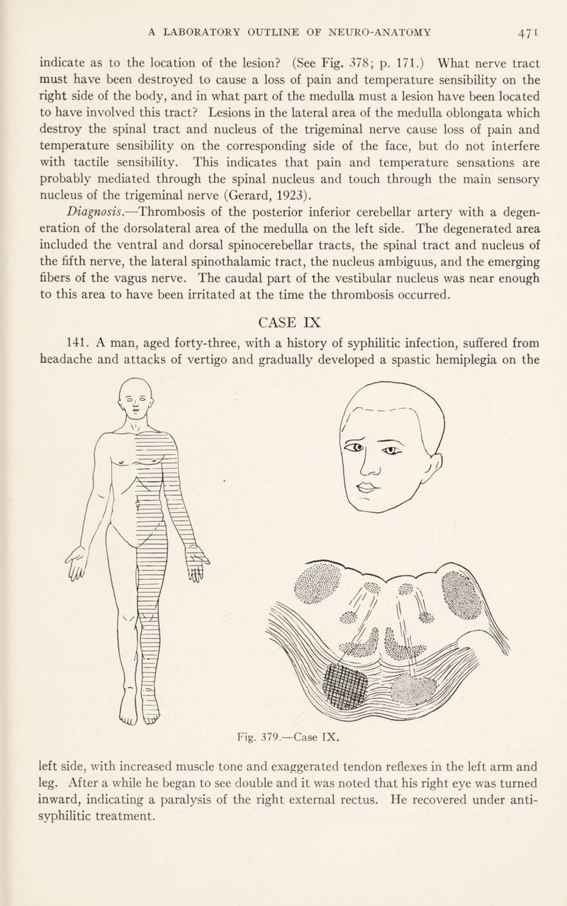 indicate as to the location of the lesion? (See Fig. 378; p. 171.) What nerve tract must have been destroyed to cause a loss of pain and temperature sensibility on the right side of the body, and in what part of the medulla must a lesion have been located to have involved this tract? Lesions in the lateral area of the medulla oblongata which destroy the spinal tract and nucleus of the trigeminal nerve cause loss of pain and temperature sensibility on the corresponding side of the face, but do not interfere with tactile sensibility. This indicates that pain and temperature sensations are probably mediated through the spinal nucleus and touch through the main sensory nucleus of the trigeminal nerve (Gerard, 1923). Diagnosis.—Thrombosis of the posterior inferior cerebellar artery with a degen¬ eration of the dorsolateral area of the medulla on the left side. The degenerated area included the ventral and dorsal spinocerebellar tracts, the spinal tract and nucleus of the fifth nerve, the lateral spinothalamic tract, the nucleus ambiguus, and the emerging fibers of the vagus nerve. The caudal part of the vestibular nucleus was near enough to this area to have been irritated at the time the thrombosis occurred. CASE IX 141. A man, aged forty-three, with a history of syphilitic infection, suffered from headache and attacks of vertigo and gradually developed a spastic hemiplegia on the Fig. 379.—Case IX. left side, with increased muscle tone and exaggerated tendon reflexes in the left arm and leg. After a while he began to see double and it was noted that his right eye was turned inward, indicating a paralysis of the right external rectus. He recovered under anti¬ syphilitic treatment.