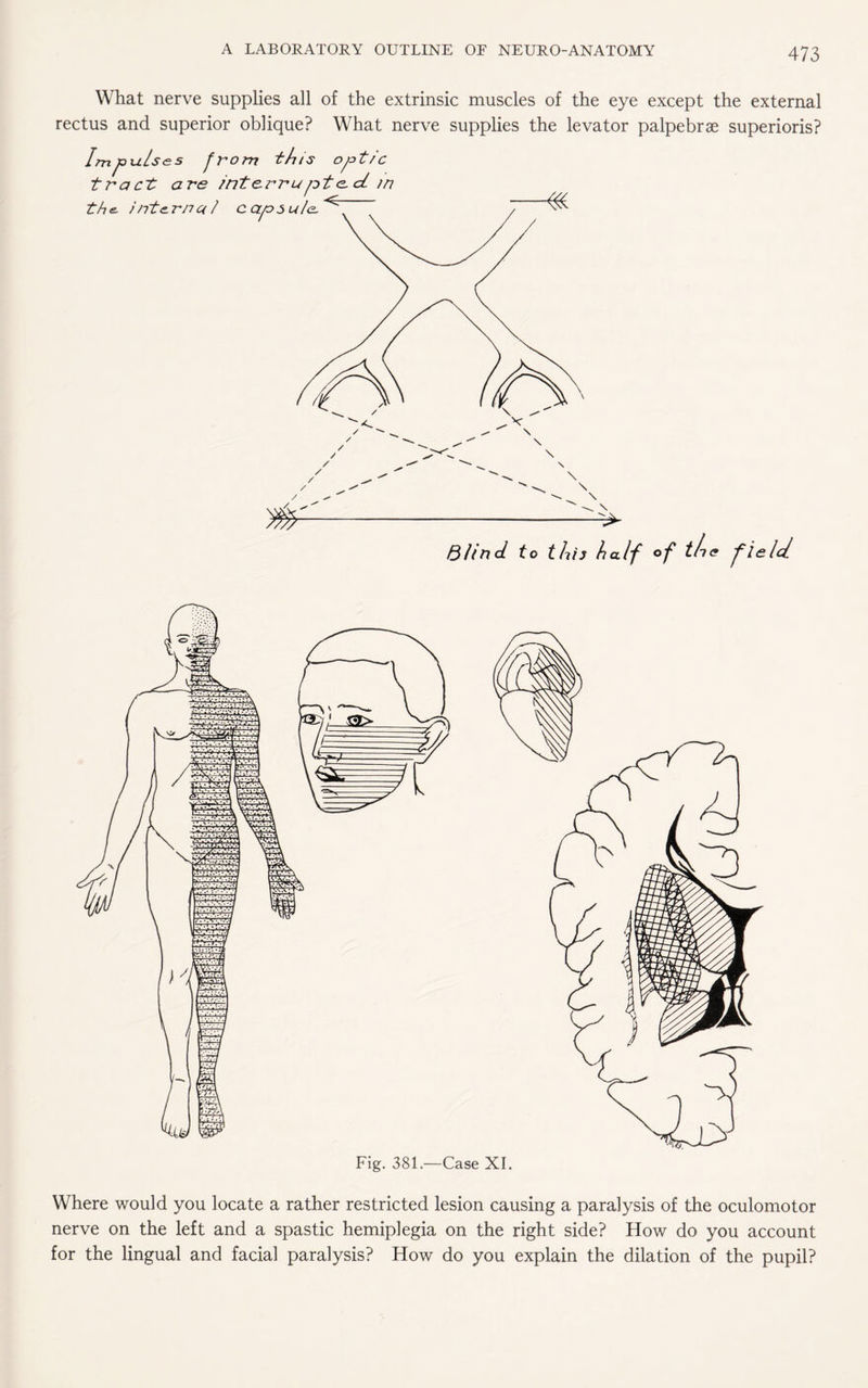 What nerve supplies all of the extrinsic muscles of the eye except the external rectus and superior oblique? What nerve supplies the levator palpebrae superioris? Q/ind to this half of the field Fig. 381.—Case XI. Where would you locate a rather restricted lesion causing a paralysis of the oculomotor nerve on the left and a spastic hemiplegia on the right side? How do you account for the lingual and facial paralysis? How do you explain the dilation of the pupil?