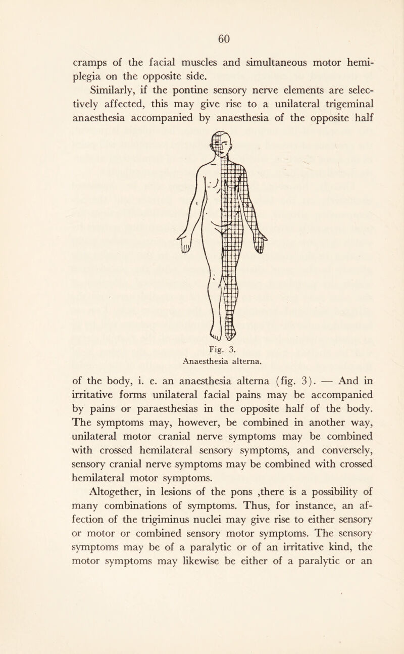 cramps of the facial muscles and simultaneous motor hemi¬ plegia on the opposite side. Similarly, if the pontine sensory nerve elements are selec¬ tively affected, this may give rise to a unilateral trigeminal anaesthesia accompanied by anaesthesia of the opposite half of the body, i. e. an anaesthesia alterna (fig. 3). — And in irritative forms unilateral facial pains may be accompanied by pains or paraesthesias in the opposite half of the body. The symptoms may, however, be combined in another way, unilateral motor cranial nerve symptoms may be combined with crossed hemilateral sensory symptoms, and conversely, sensory cranial nerve symptoms may be combined with crossed hemilateral motor symptoms. Altogether, in lesions of the pons ,there is a possibility of many combinations of symptoms. Thus, for instance, an af¬ fection of the trigiminus nuclei may give rise to either sensory or motor or combined sensory motor symptoms. The sensory symptoms may be of a paralytic or of an irritative kind, the motor symptoms may likewise be either of a paralytic or an