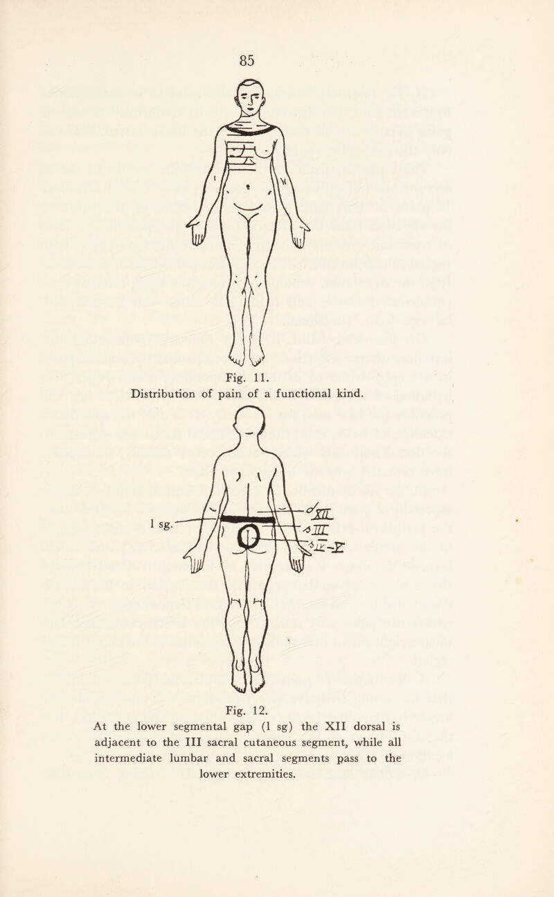 Fig. 11. Distribution of pain of a functional kind. Fig. 12. At the lower segmental gap (1 sg) the XII dorsal is adjacent to the III sacral cutaneous segment, while all intermediate lumbar and sacral segments pass to the lower extremities.