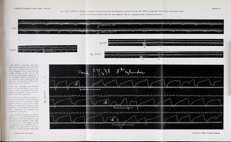 Fig. XXIV—XXVIII. Changes of respiration and pulsation during the stimulation of point 16 (see fig. XX—XXIV, on page 335) of the cortex of the brain of dogs. In all curves the abscis and the time have been registered. Time by a tuning-fork with 2 vibrations per second. Fig. XX vu a i Fig. XXIV. Respiration and pulsa¬ tion of a dog registered i July, 15th 1898). Ad d and e — point 15 and 16 the cor¬ tex is stimulated with a weak induction current i distance of the coils 11 cM.) During the stimulation acceleration of the respiration, specially shortening of the expiration, which continues for some time after the stimulation. Then strong lengthening of the expiration. Fig. XXV. Respiration and pulsation of a dog (July 12th 1898). At e = point 16 the cortex is stimulated. Quick and superficial respiration, during, long ex¬ piration after the stimulation. Fig. XXVI and XXVII. As before of a dog July 9th 1898). At III stimulation of point 16 with a moderately strong current (distance of the coils 8 à 9 cM). During the stimulation tendency to deep inspiration and acceleration of the pulse. Then lengthening of expiration and retardation of the pulse. Fig. XXVIII. Respiration (a) and pul¬ sation b) of a dog (July 27th 1898). At 16 stimulation with the induction current during the time indicated by the signal. In every phasis of the respiration, both in inspiration, and expiration, deep in¬ spiration and acceleration of the pulse, as well as quicker respiration takes place. b a