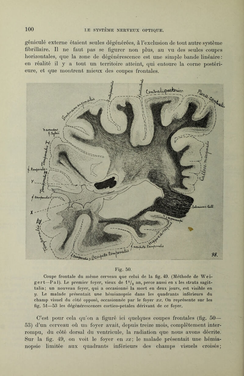géniculé externe étaient seules dégénéi'ées, à l’exclusion de tout autre système fibrillaire. Il ne faut pas se figurer non plus, au vu des seules coupes horizontales, que la zone de dégénérescence est une simple bande linéaire : en réalité il y a tout un territoire atteint, qui entoure la corne postéri¬ eure, et que montrent mieux des coupes frontales. b N/ I lUl Fig. 50. Coupe frontale du même cerveau que celui de la fig. 49. (Méthode de Wei¬ gert—Pal). Le premier foyer, vieux de 1 l/2 an, perce aussi en x les strata sagit- talia; un nouveau foyer, qui a occasionné la mort en deux jours, est visible en y. Le malade présentait une hémianopsie dans les quadrants inférieurs du champ visuel du côté opposé, occasionnée par le foyer xx. On représente sur les fig. 51—53 les dégénérescences cortico-petales dérivant de ce foyer. C’est pour cela qu'on a figuré ici quelques coupes frontales (fig. 50— 53) d’un cerveau où un foyer avait, depuis treize mois, complètement inter¬ rompu, du côté dorsal du ventricule, la radiation que nous avons décrite. Sur la fig. 49, on voit le foyer en xx; le malade présentait une hémia¬ nopsie limitée aux quadrants inférieurs des champs visuels croisés;